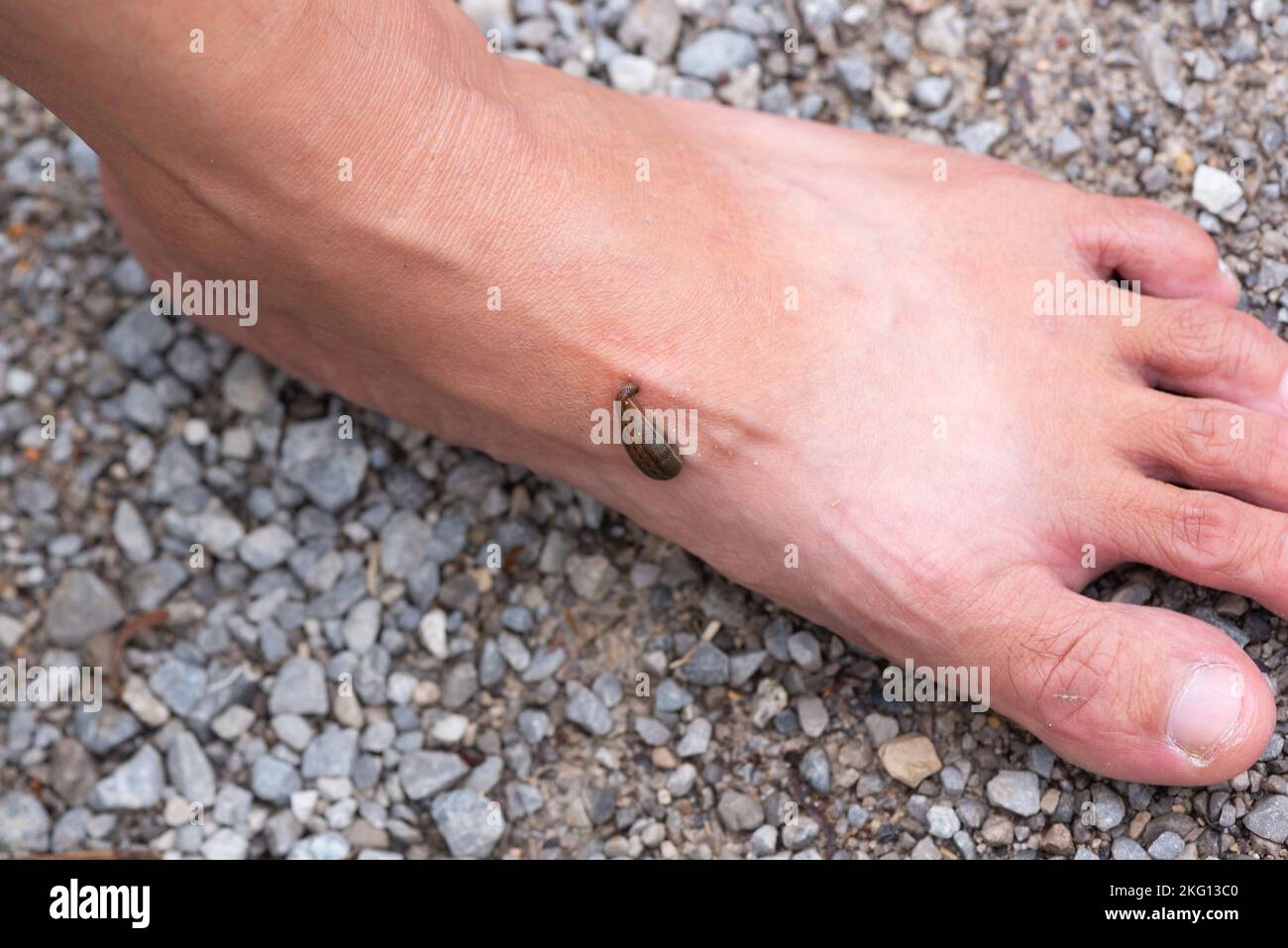 A leech sucking blood on the woman foot. Stock Photo