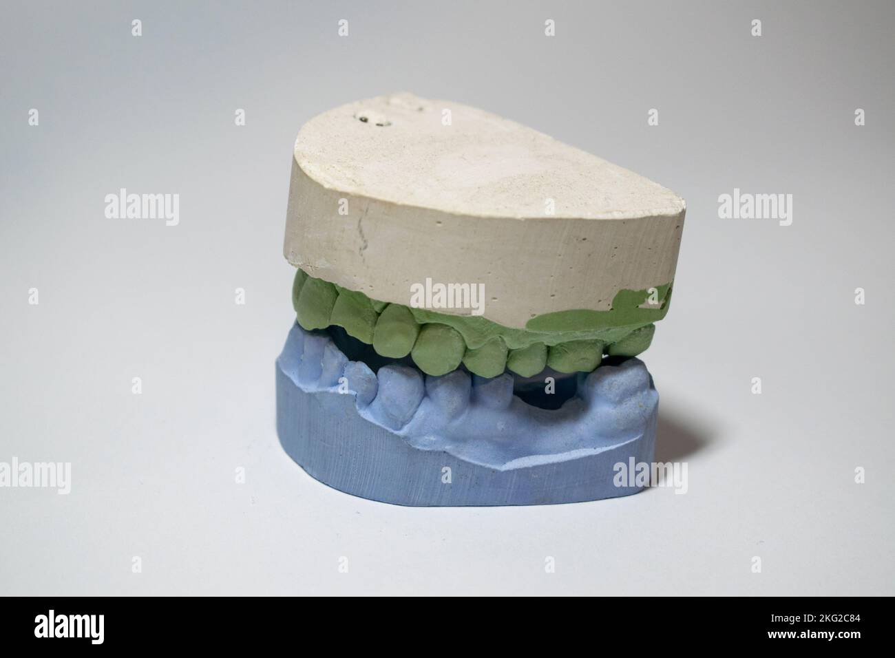 Plaster impressions of the teeth of the lower and upper jaws for prosthetics and implantation in dentistry. Stock Photo