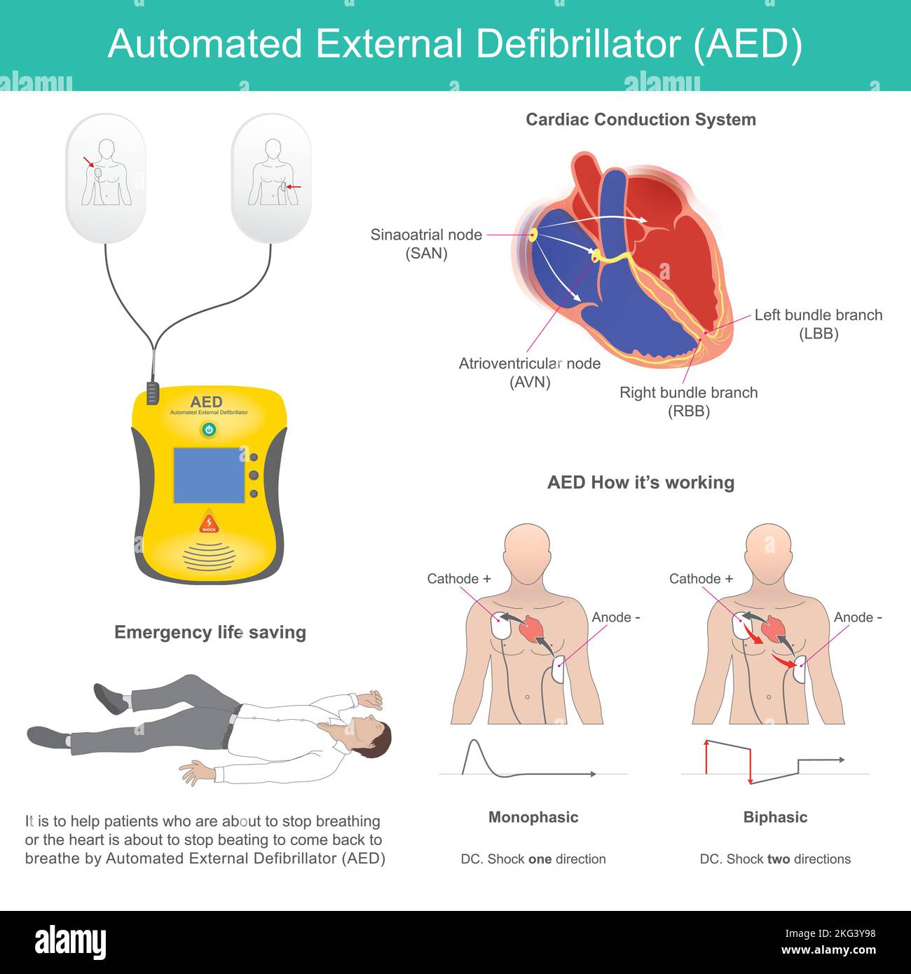 Automated External Defibrillator. It is electronic device for life support that recognises ventricular fibrillation and other dysrhythmias and deliver Stock Vector