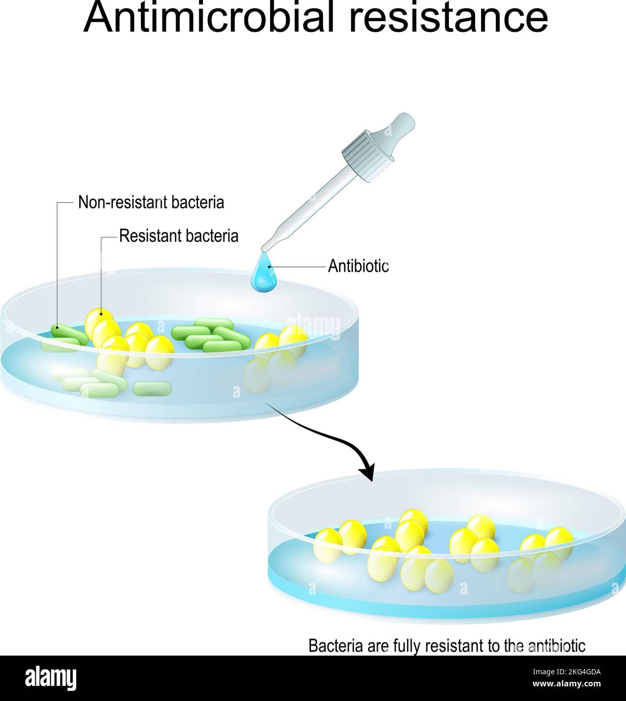 Antimicrobial resistance. Non-resistant and Resistant bacteria. colonies of bacteria Before and after Antibiotic therapy. Pipette with antibiotic Stock Vector