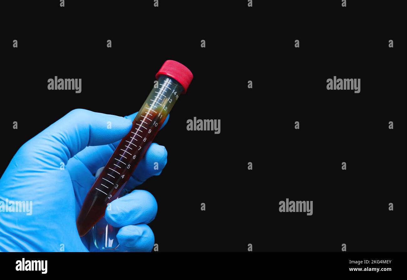 Blood sample in test tube holding by doctor hand, object isolated with