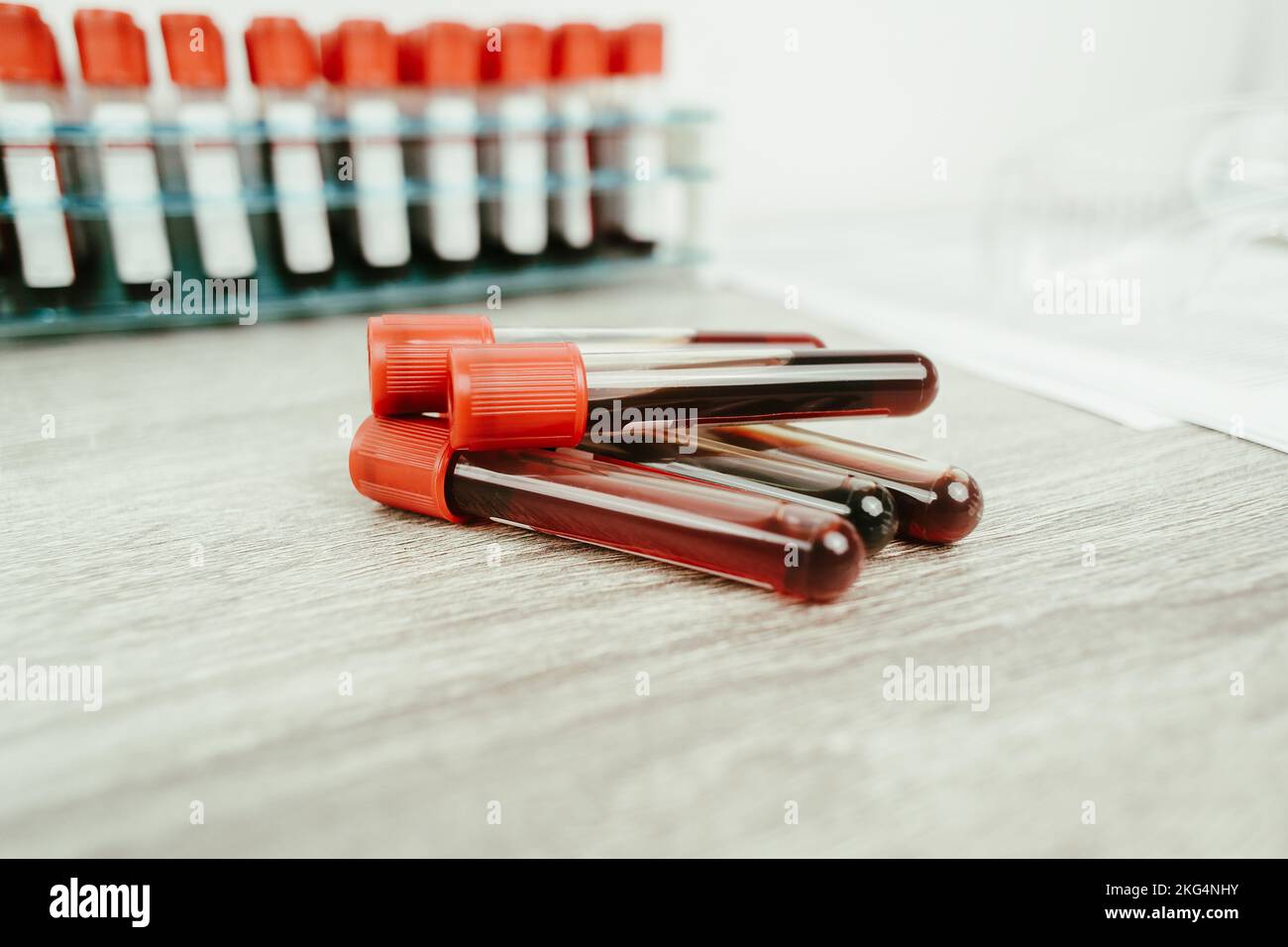 A blood test sample tube pile with a red cap on desk in the hematology