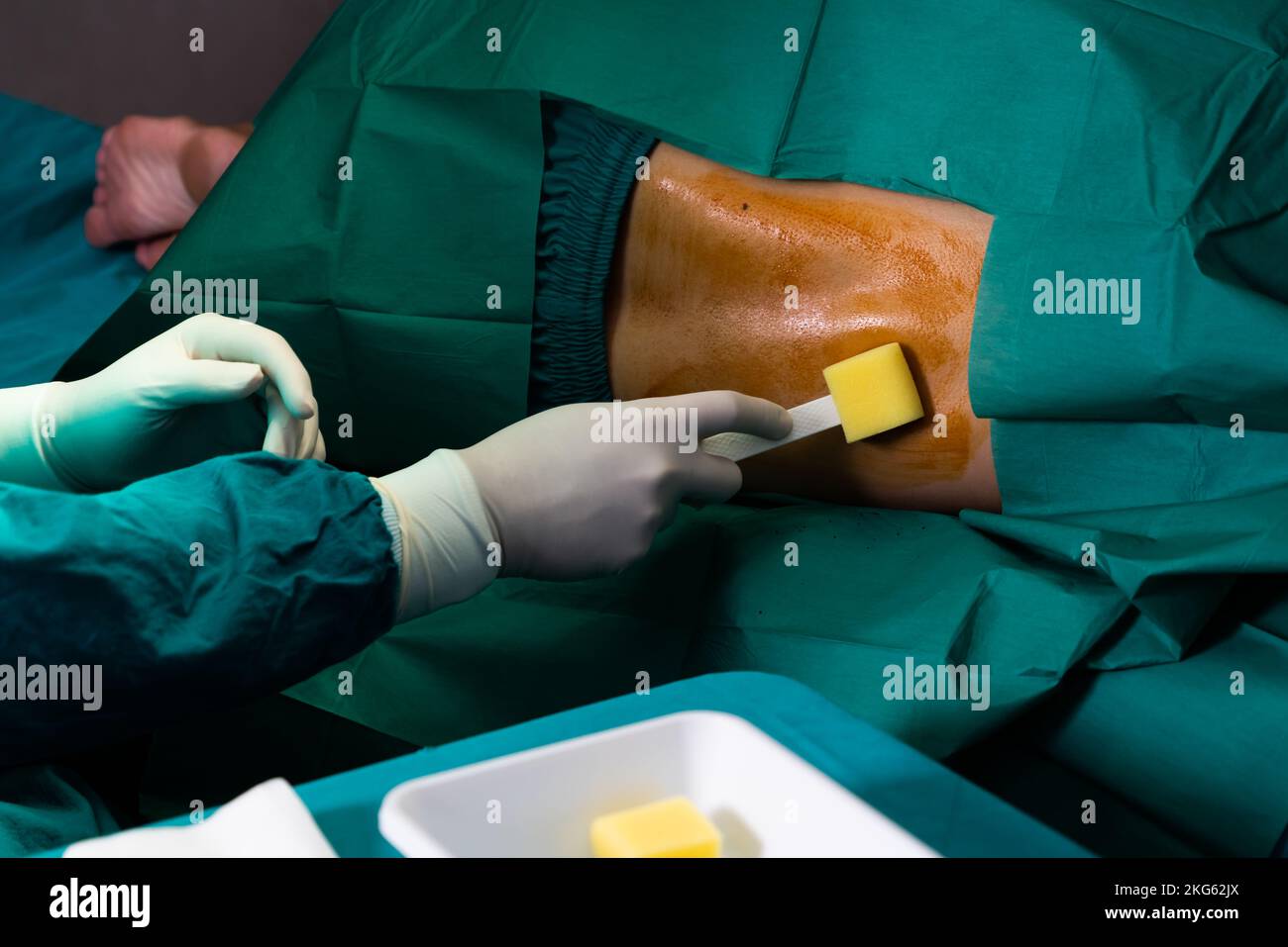 Doctor or surgeon apply betadine to the patient for anesthesia