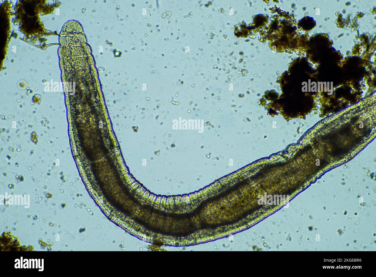 human parasites in the human gut health Stock Photo