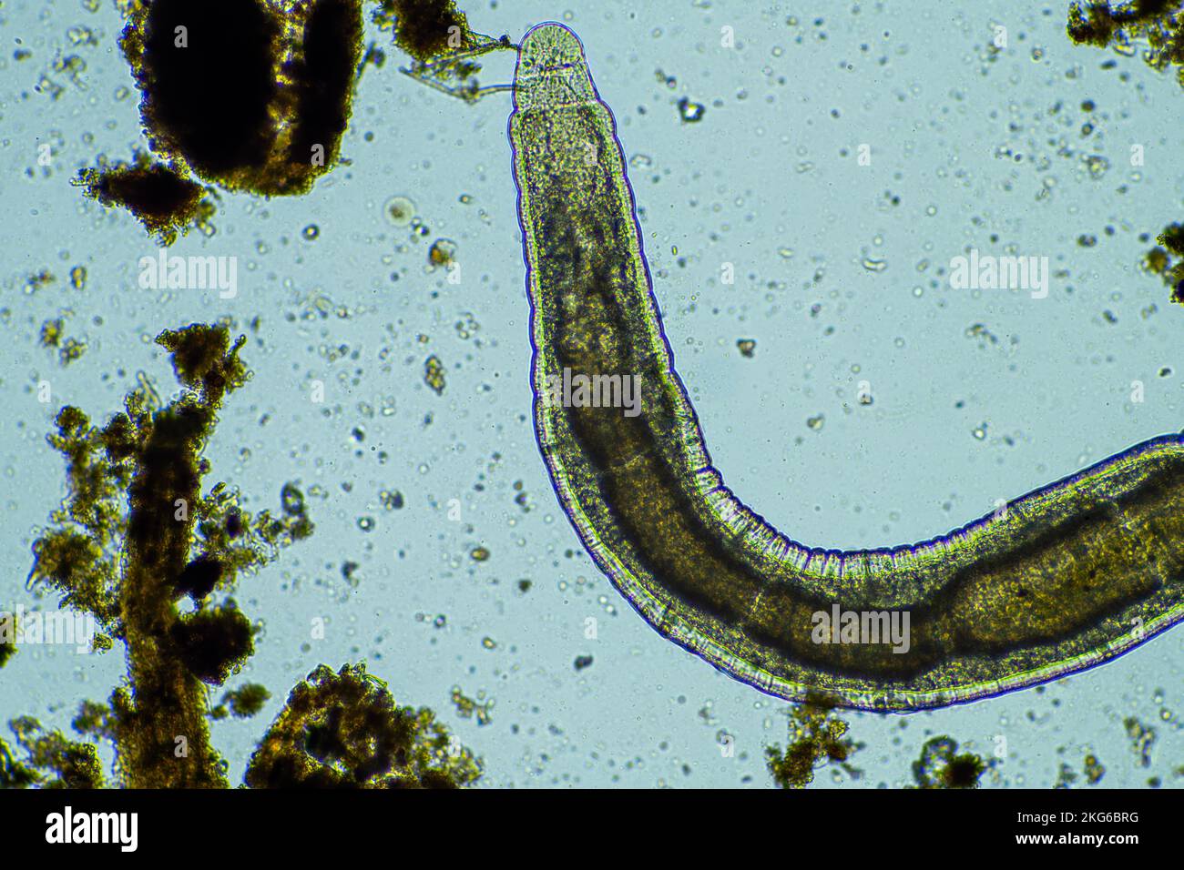 human parasites in the human gut health Stock Photo