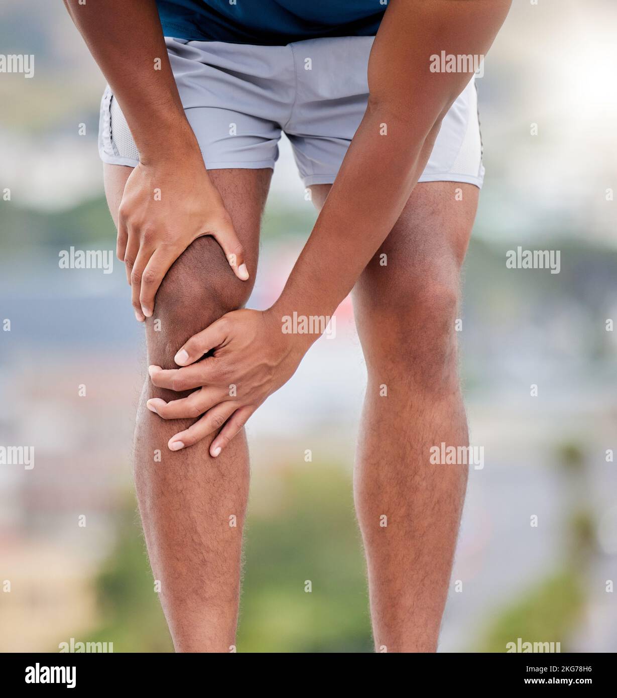 Man, legs and running injury in nature park for wellness exercise