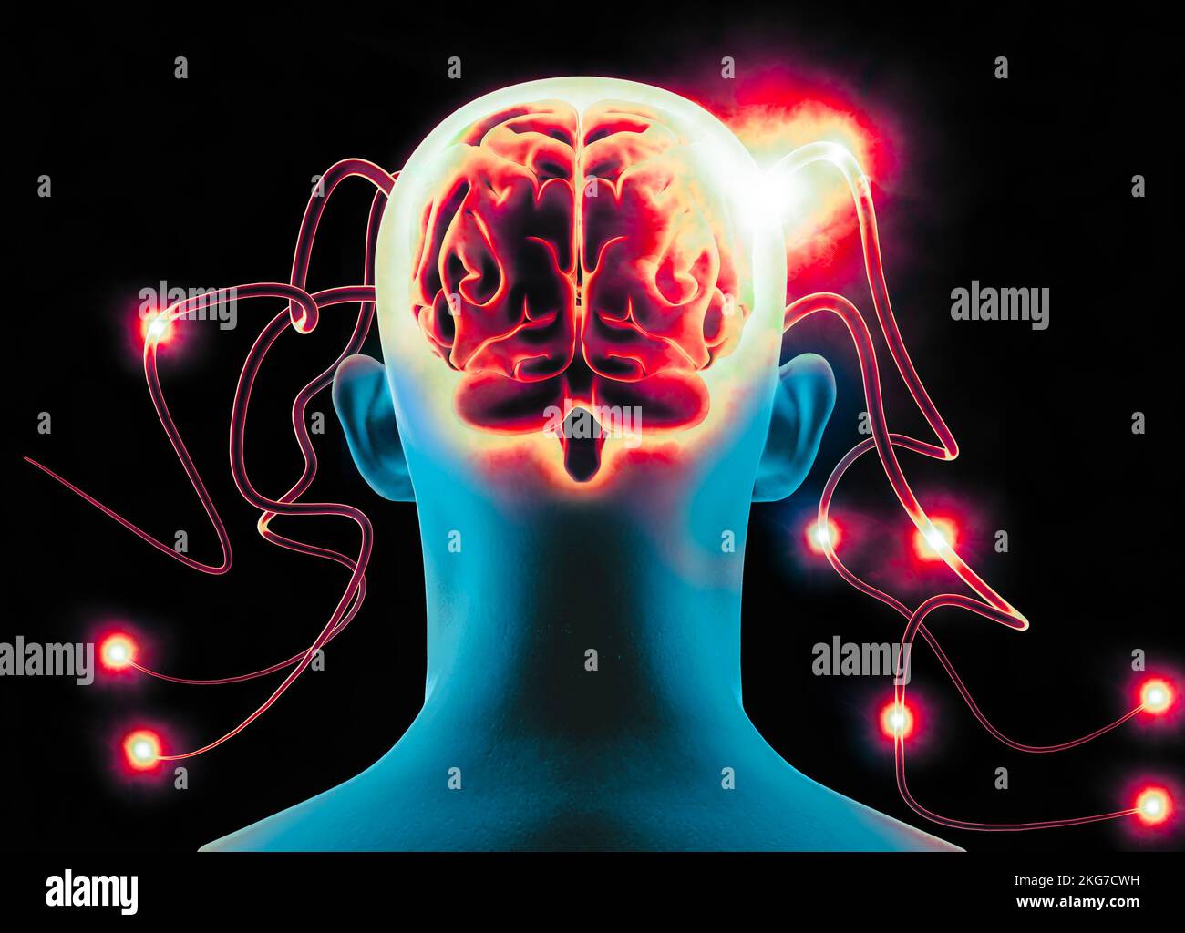 Artificial intelligence, stimuli and instructions imparted to the brain by an external intelligence. Human head seen from the back, neurons Stock Photo