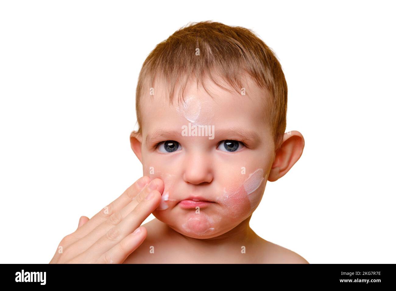 Mother smears allergy cream on face of toddler baby, studio white