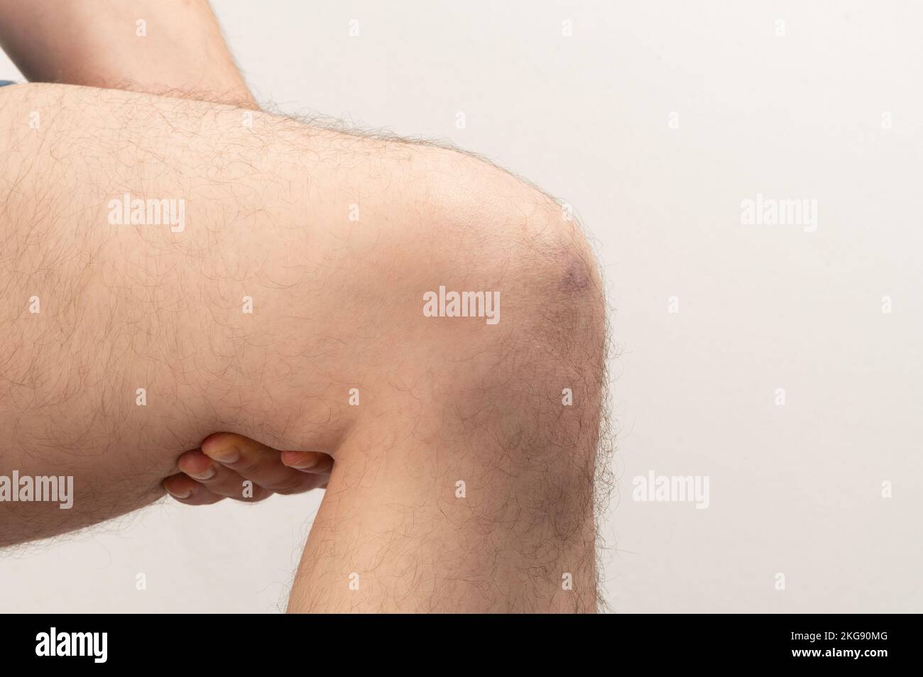Knee therapy theme. Checking leg on wound isolated on studio background Stock Photo