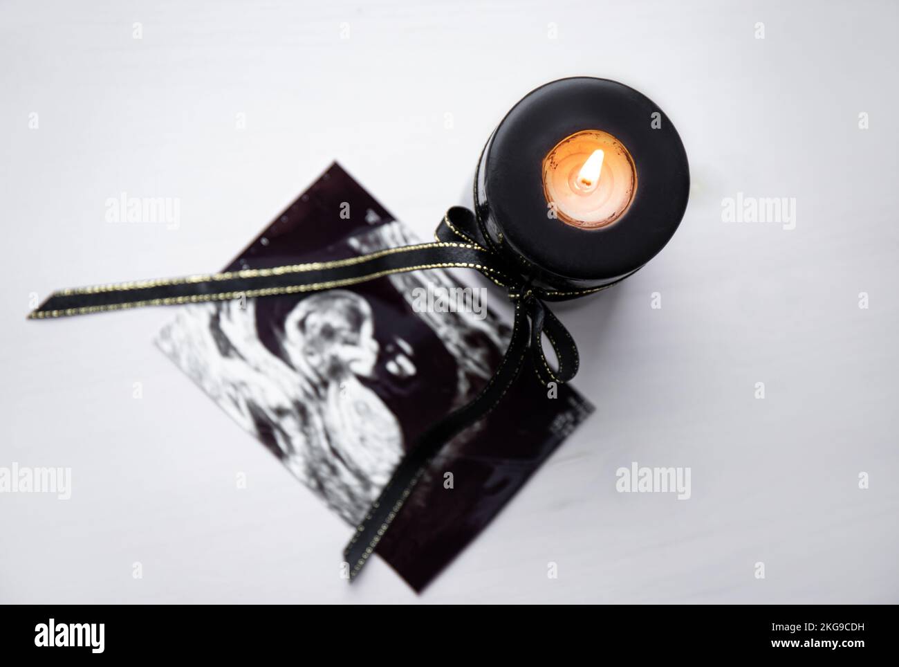 Conceptual image of mourning, miscarriage, pregnancy loss or grief counseling. Ultrasound picture of baby next to black candle with black ribbon burni Stock Photo