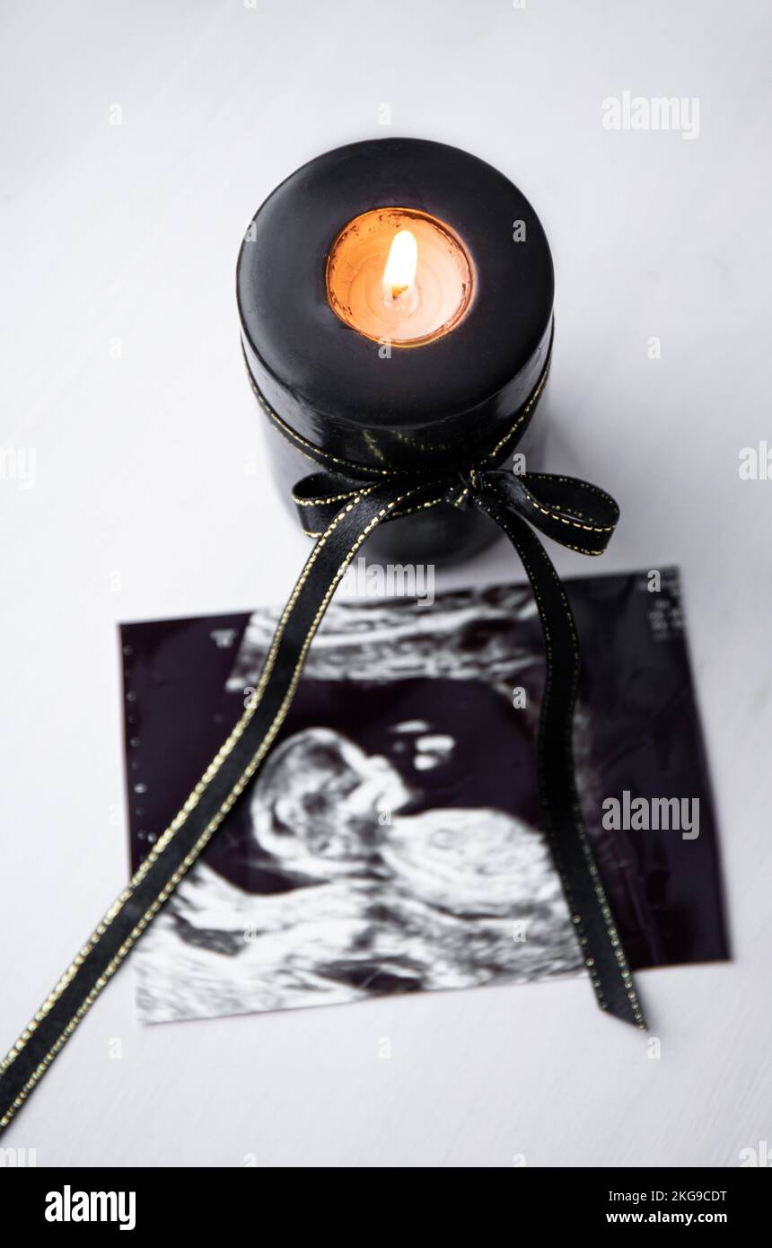 Conceptual image of mourning, miscarriage, pregnancy loss or grief counseling. Ultrasound picture of baby next to black candle with black ribbon burni Stock Photo