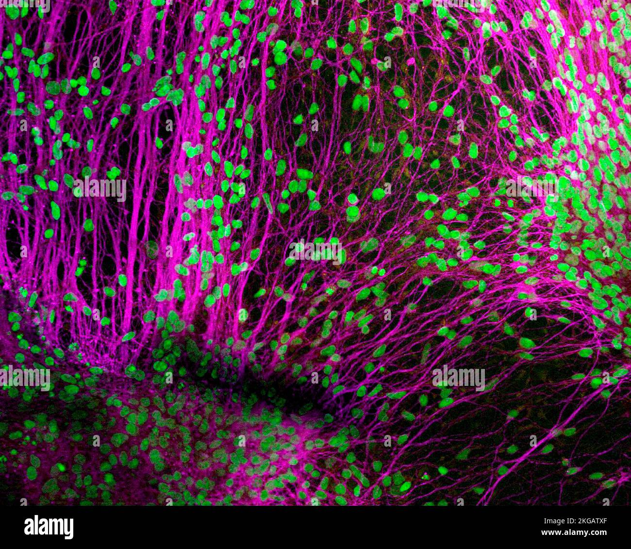 Fluorescence light micrograph of nerve cells (neurons) that have been derived from induced pluripotent stem cells (IPS). Pluripotent stem cells are ab Stock Photo