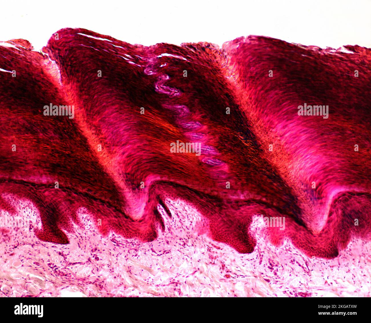 Light micrograph of a section through human skin with an eccrine sweat ...