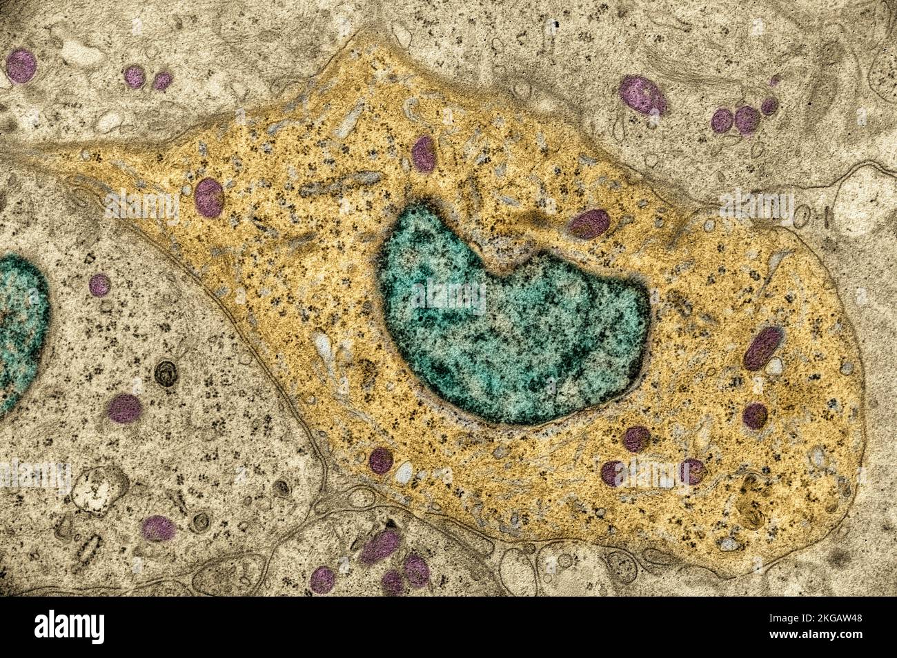 Coloured transmission electron micrograph (TEM) of a section through ...