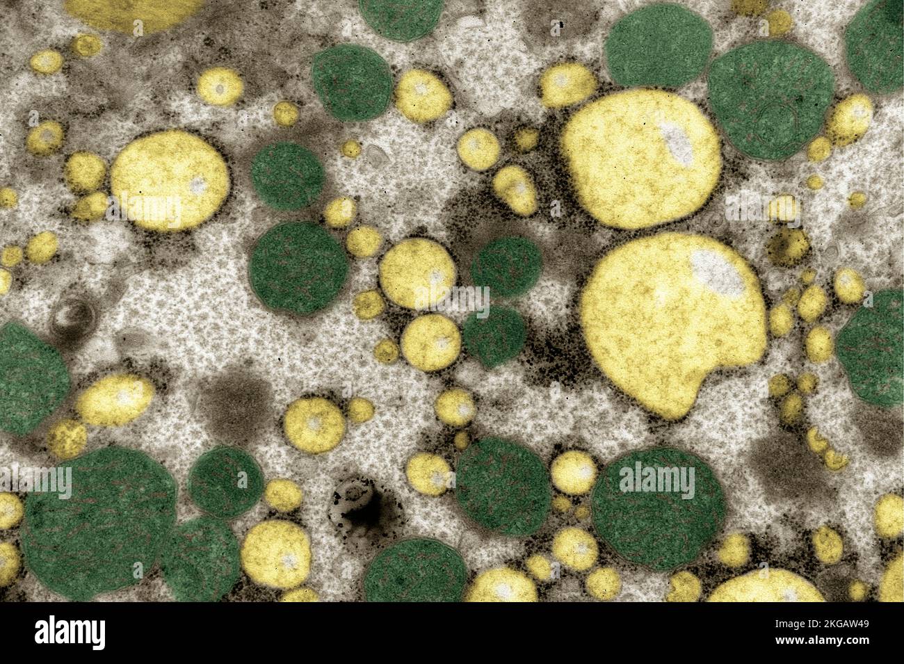 Coloured transmission electron micrograph (TEM) of a section through ...