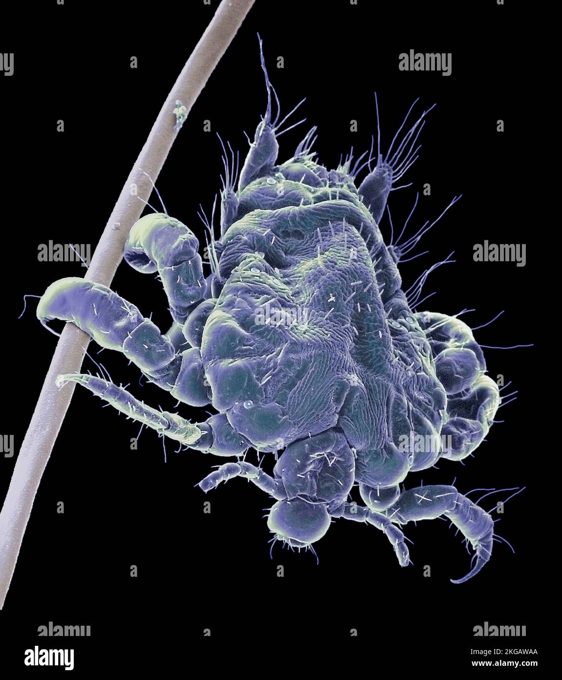 Pubic louse. Scanning electron micrograph (SEM) of the pubic louse ...