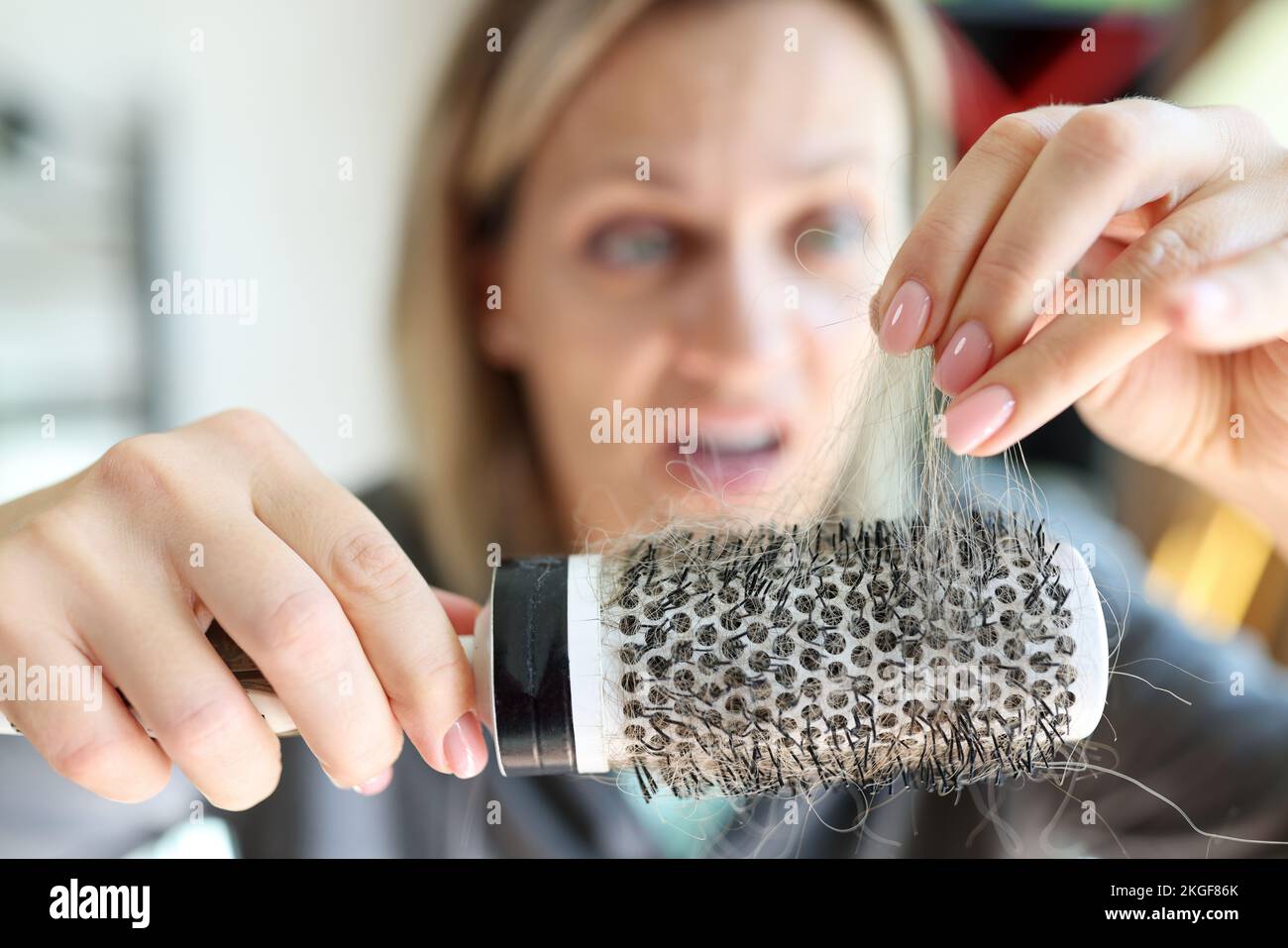 Hair loss problem and unhealthy hair. Frustrated and frightened woman