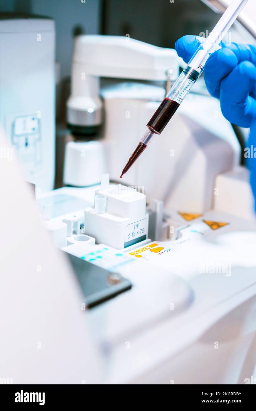 Hand of doctor analyzing blood sample at laboratory Stock Photo Alamy