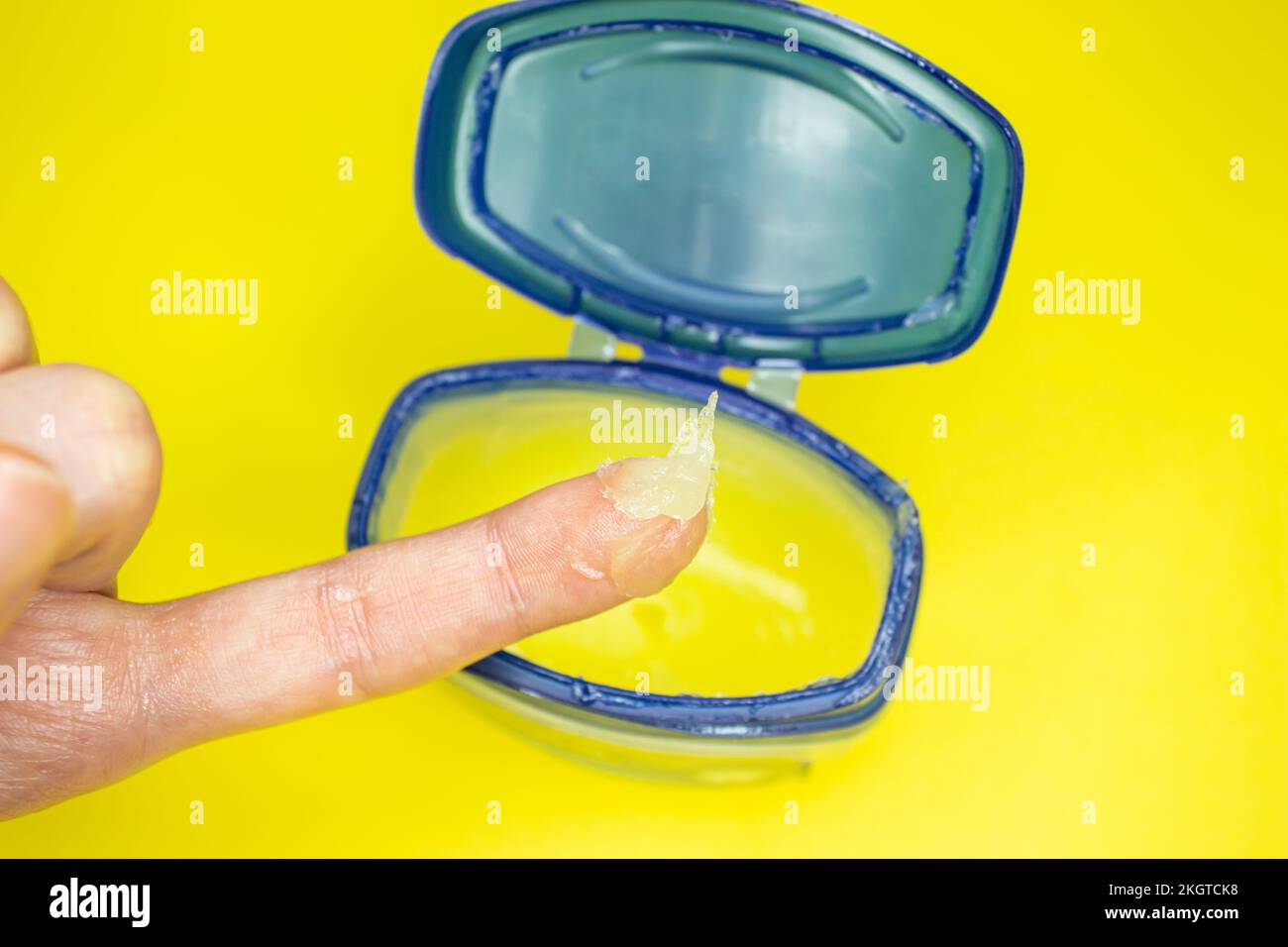 Hand with petroleum jelly. Skin care concept idea photo. Close up of