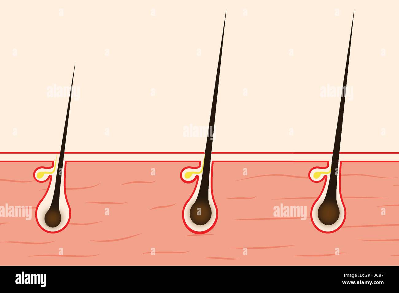 Hair growing concept with a human skin illustration. Hair follicles