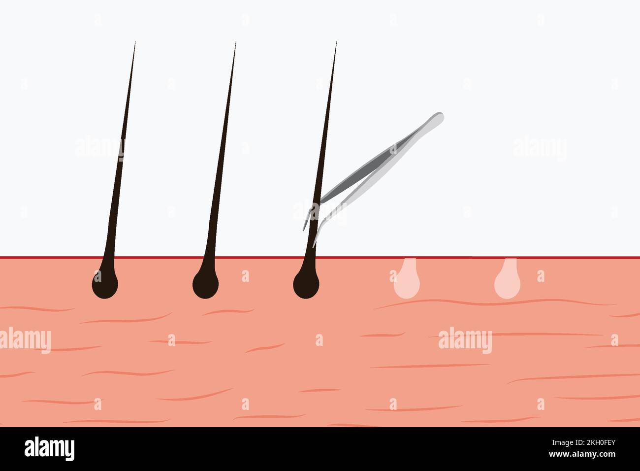 Pulling out body hair with a tweezer vector. Using a tweezer to pull