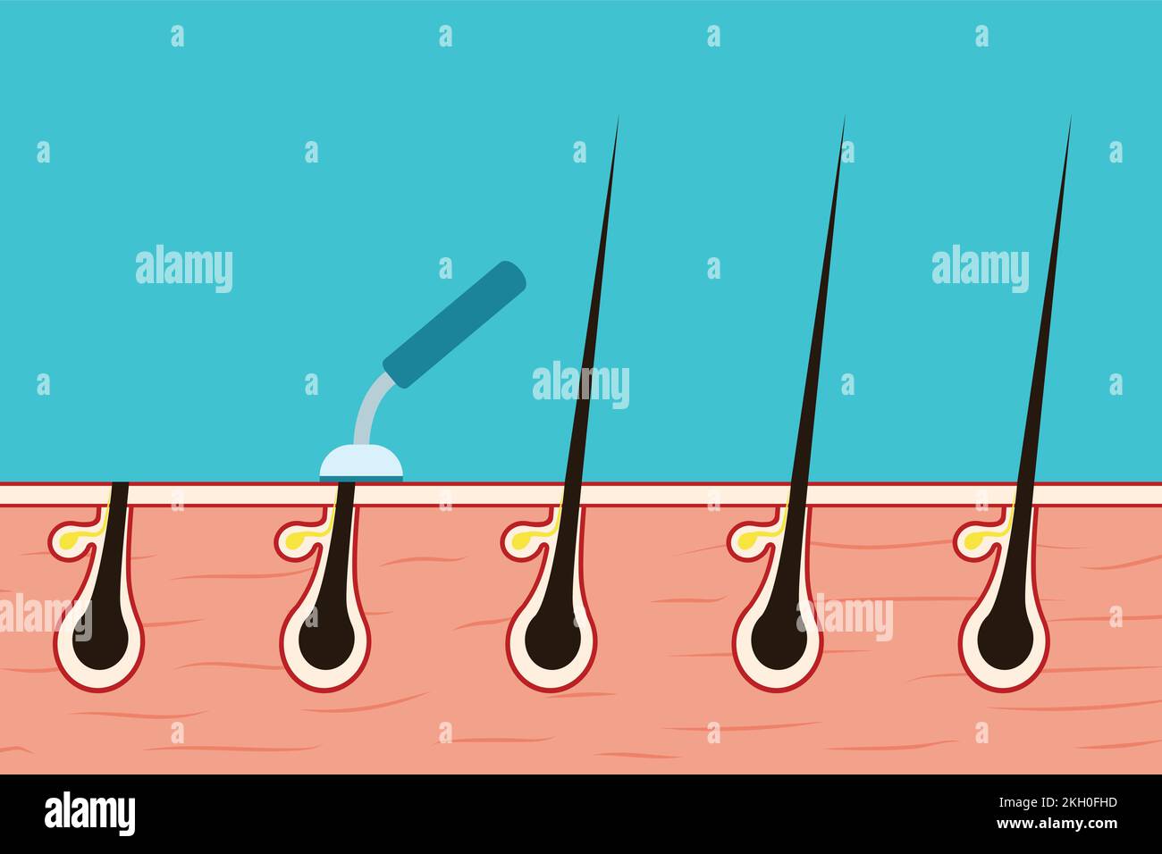 Removing body hair with a shaver concept vector. Shaving hair from the