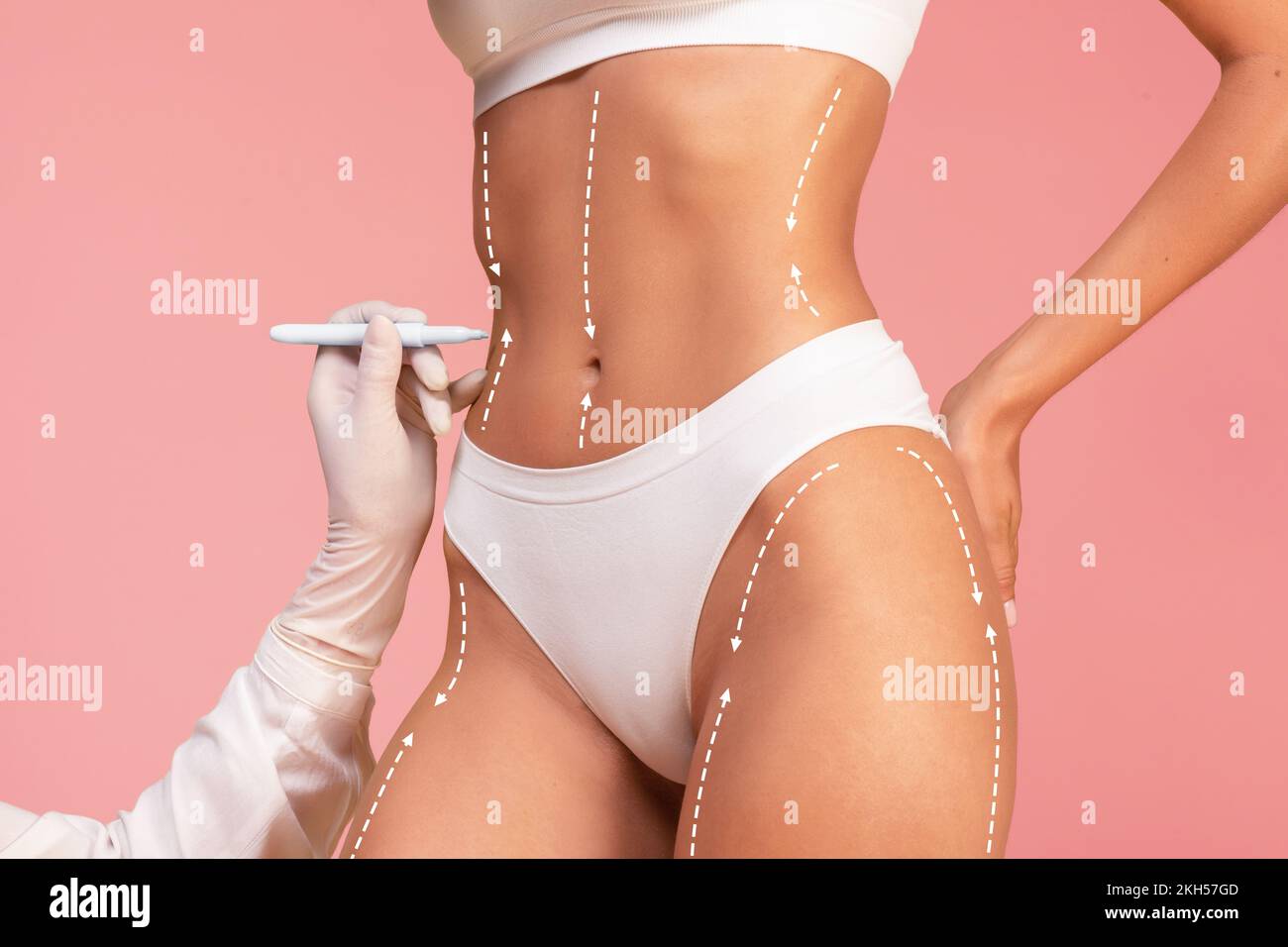 Doctor Drawing Dashed Line Marks On Female Body Before Plastic Surgery Operation Stock Photo