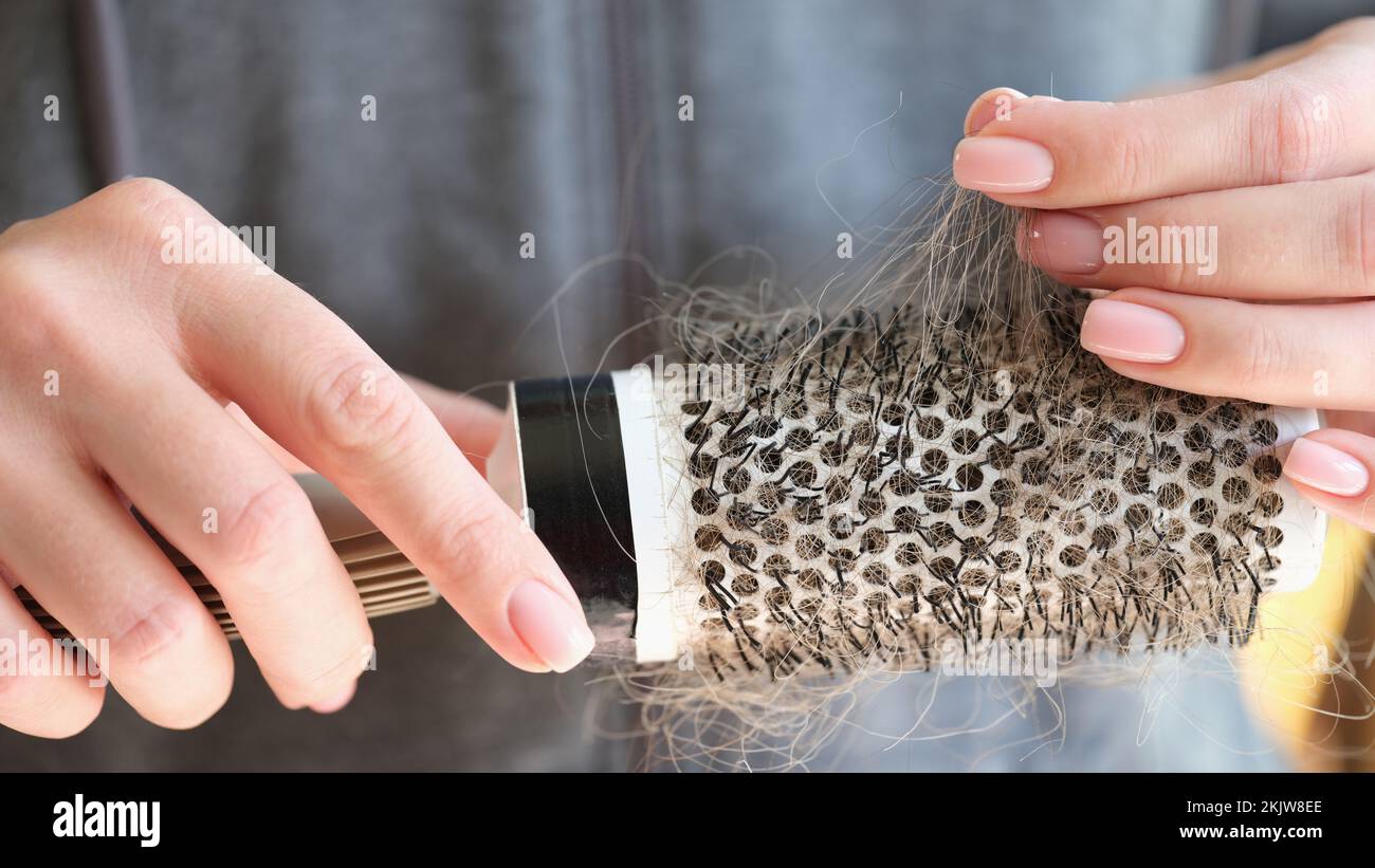 Female hands holding round shaped comb with hair loss Stock Photo