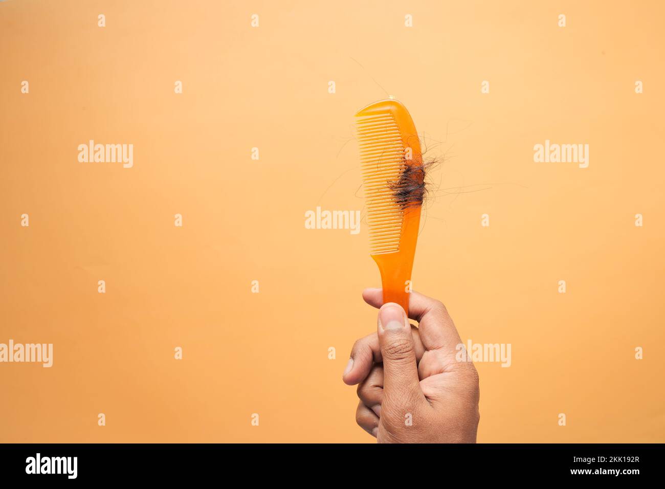 Hair loss in orange color comb, hair fall everyday serious problem,  Stock Photo