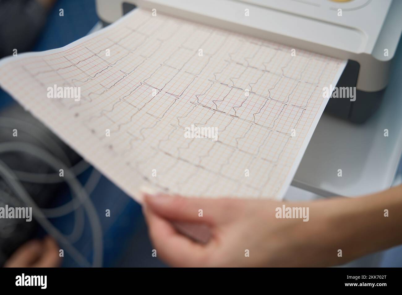 Nurse is holding printout with electrocardiogram results Stock Photo