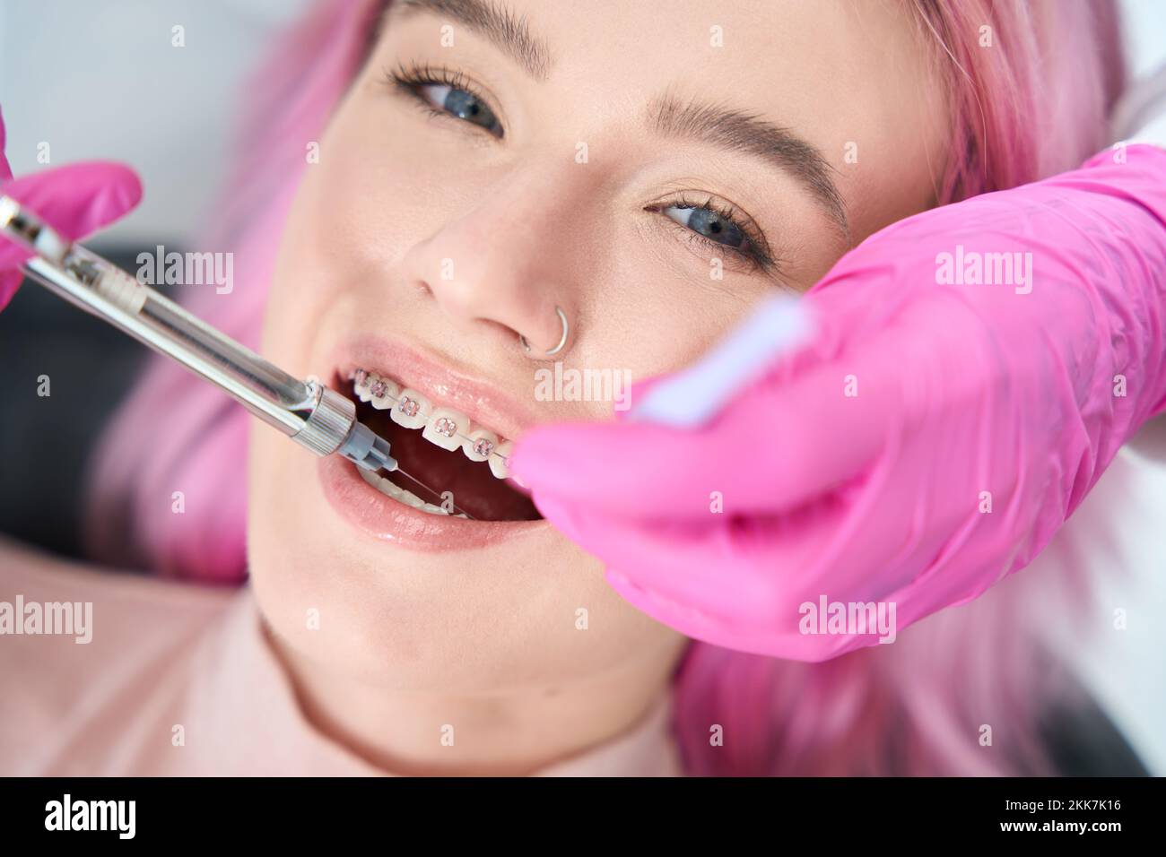 Woman with braces is given injection of anesthesia in gum Stock Photo Alamy