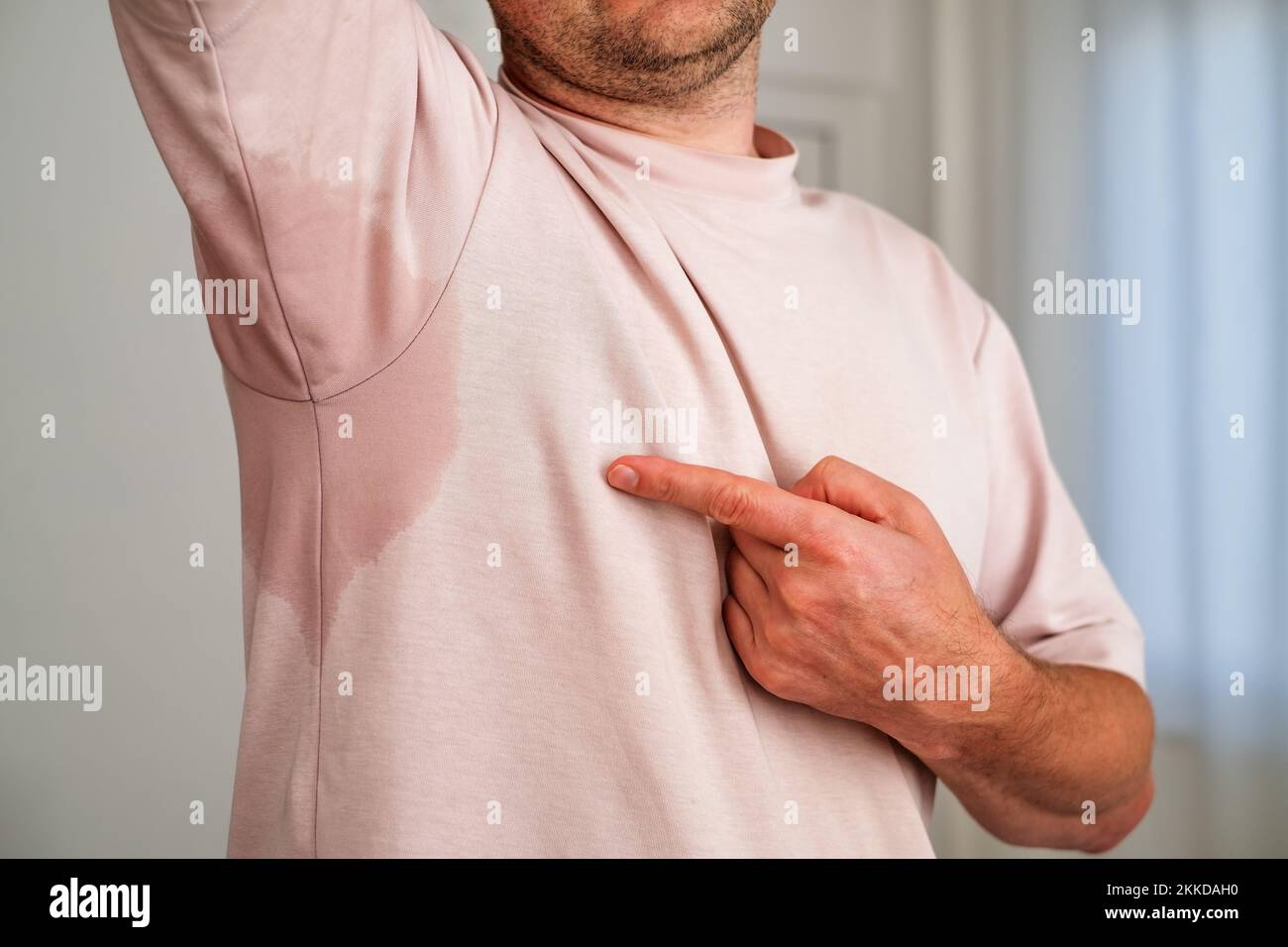 Man with hyperhidrosis sweating very badly under armpit Stock Photo - Alamy