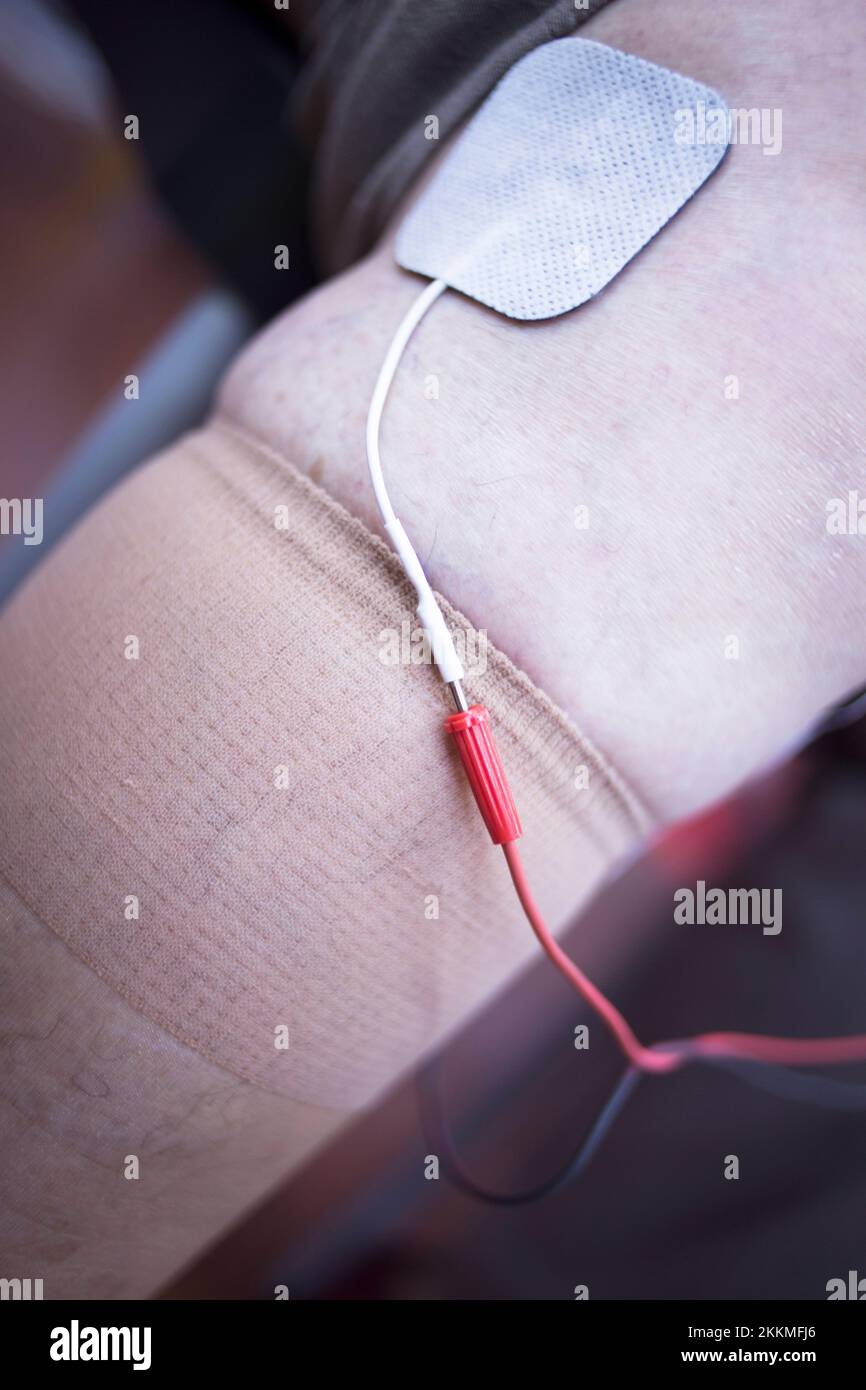 Muscle stimulation electrodes Stock Photo Alamy