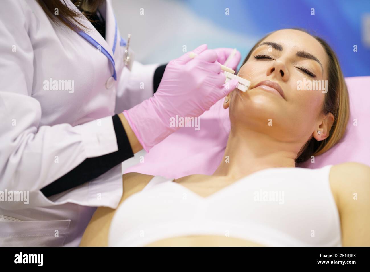 Doctor painting the area of a woman's face where the PDO suture treatment threads will be injected. Stock Photo