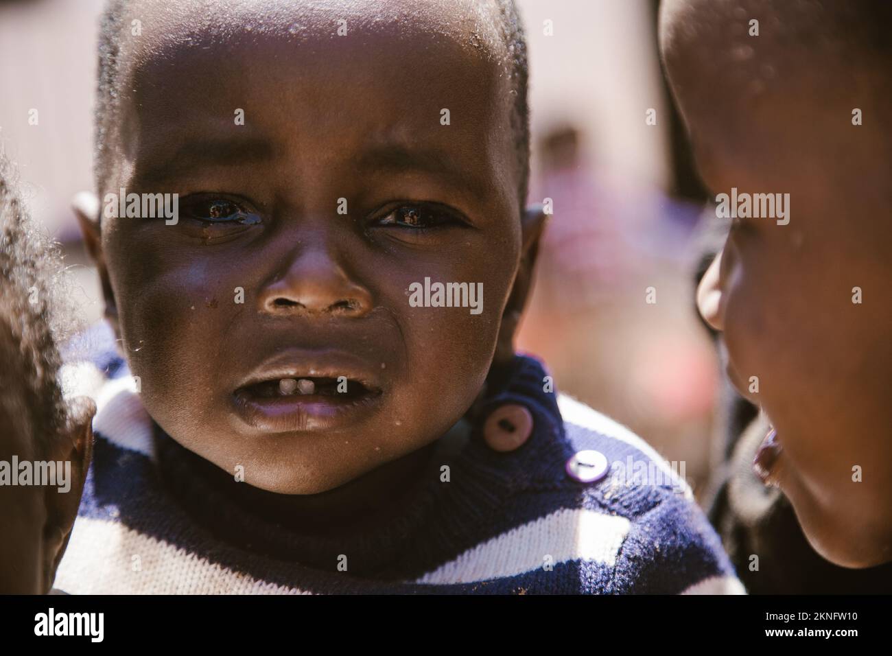Mount Elgon, Kenya - 01.25.2017: Portrait of an African American child. A missionary team came to help homeless children. Stock Photo