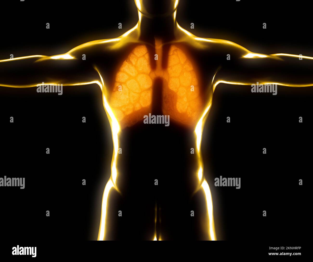 Human anatomy, problems with the respiratory system, severely damaged lungs. Bilateral pneumonia