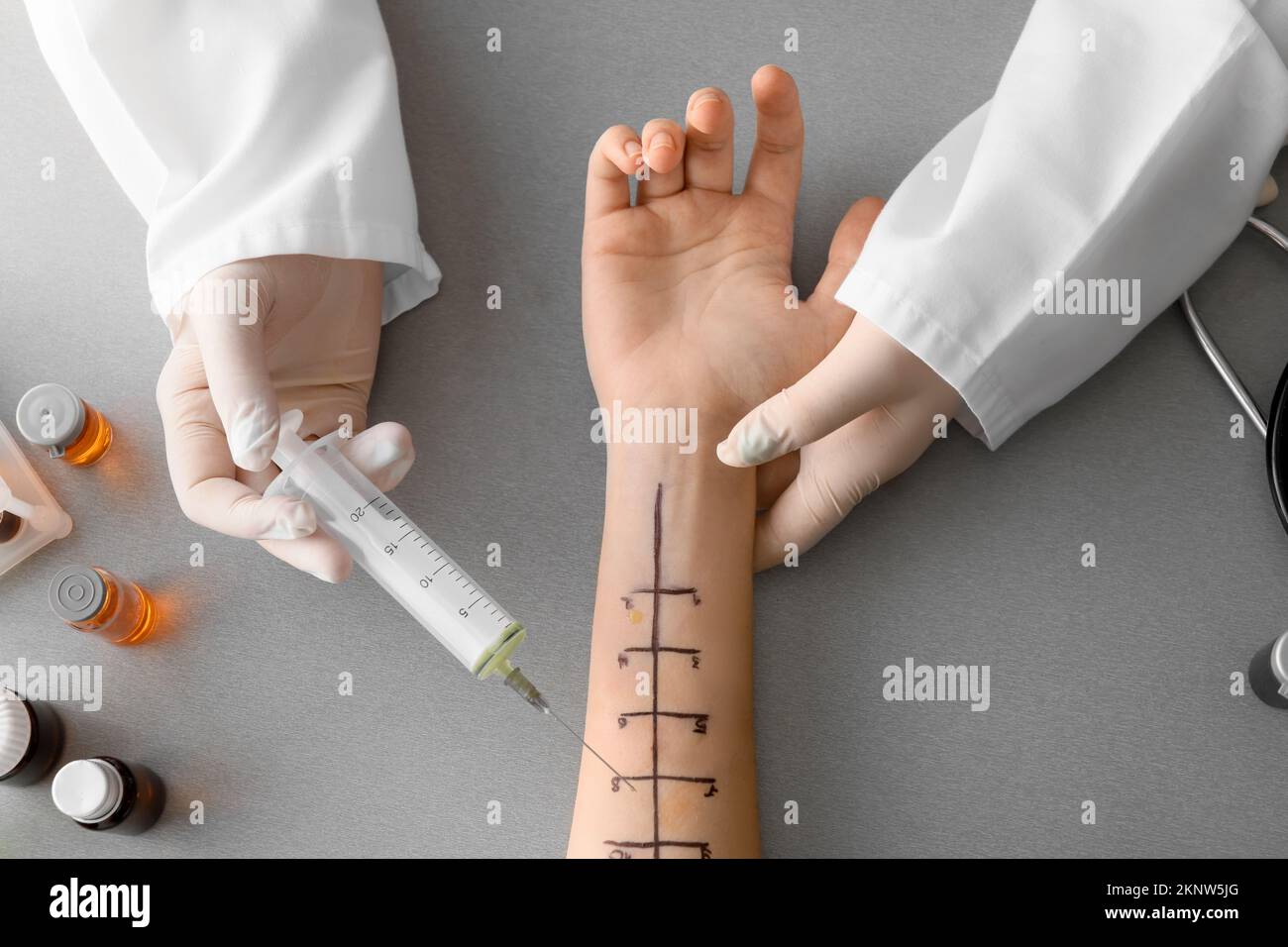 Doctor with syringe and patient's marked hand for allergy skin tests on