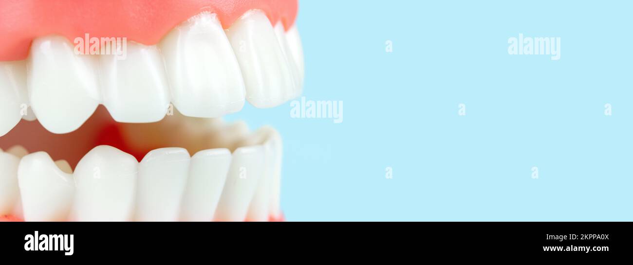 Dentures Dental Teeth Model. Complete denture or full denture on blue background. Dental teeth model. Open human upper and lower. Artificial jaw in th Stock Photo