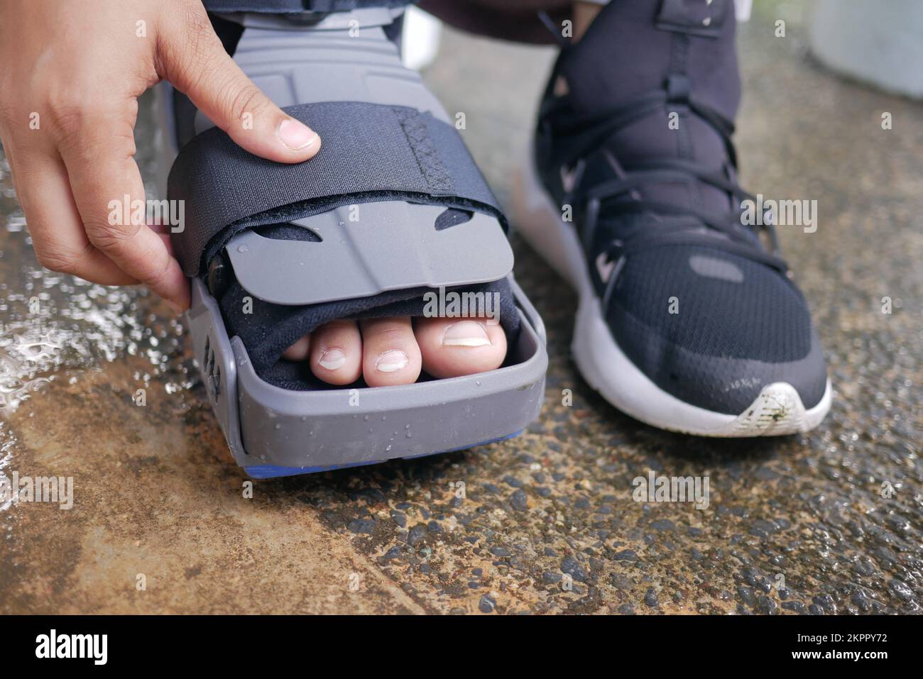 women broken feet with a grey plastic boot ankle brace injury protecting boot Stock Photo Alamy