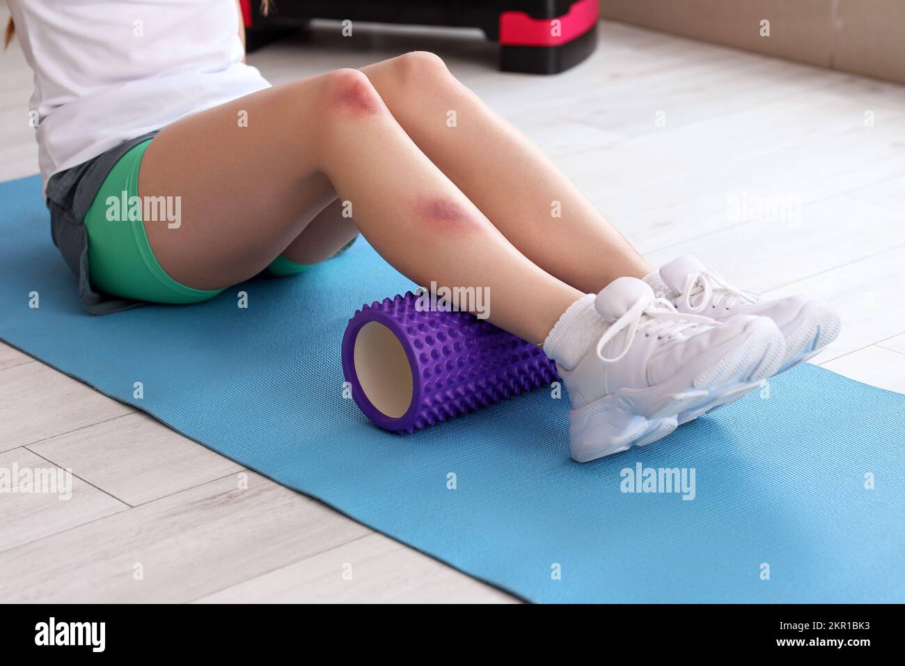 Woman bruise leg domestic violence hires stock photography and images