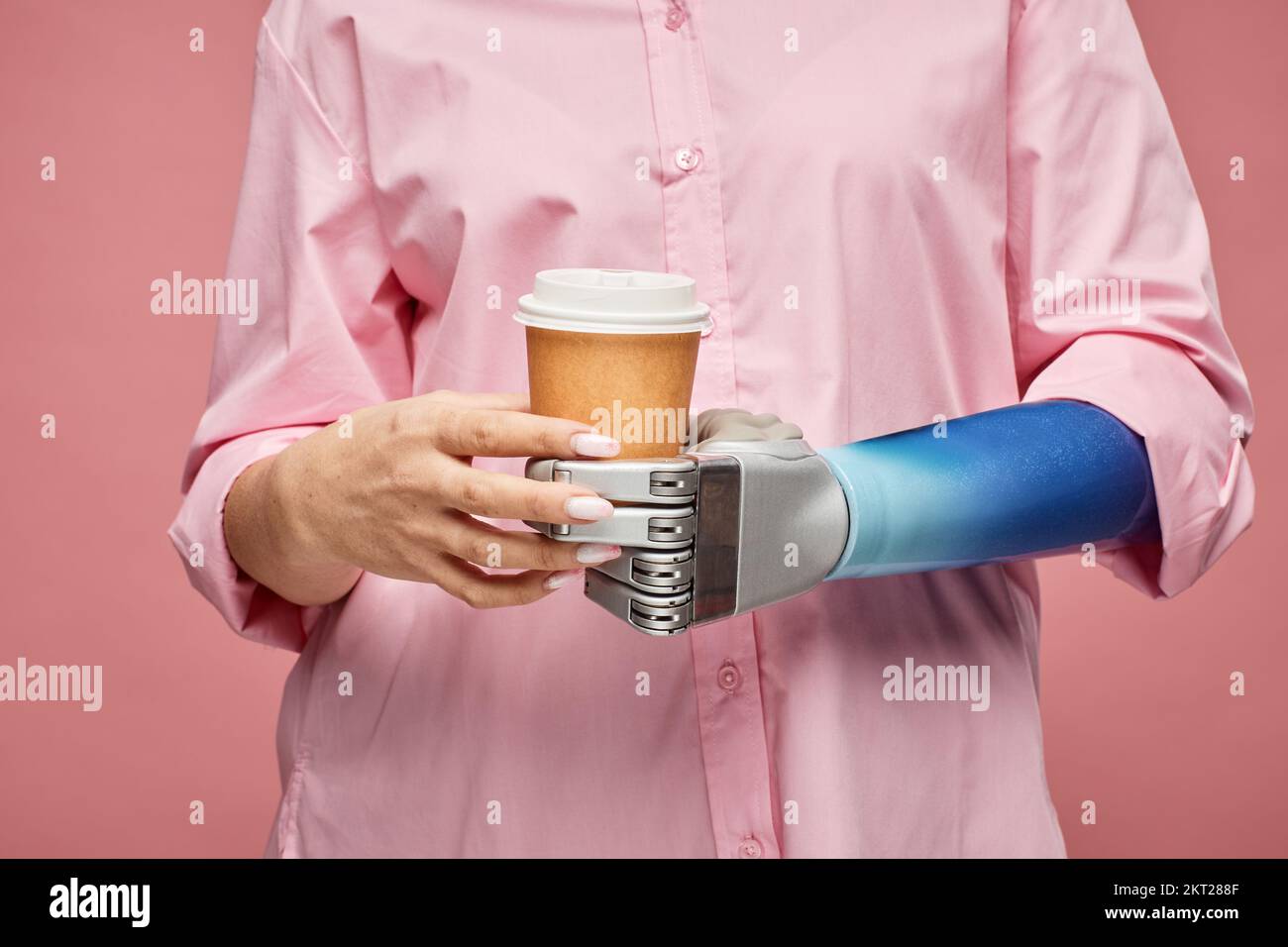 Prosthetic arm cup hi-res stock photography and images - Alamy