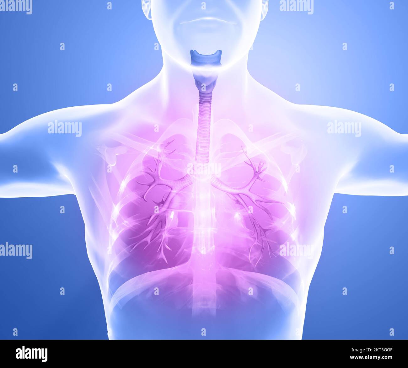 Human anatomy, problems with the respiratory system, severely damaged lungs. Bilateral pneumonia. Covid-19, coronavirus. Patient and smoke. Smoker Stock Photo