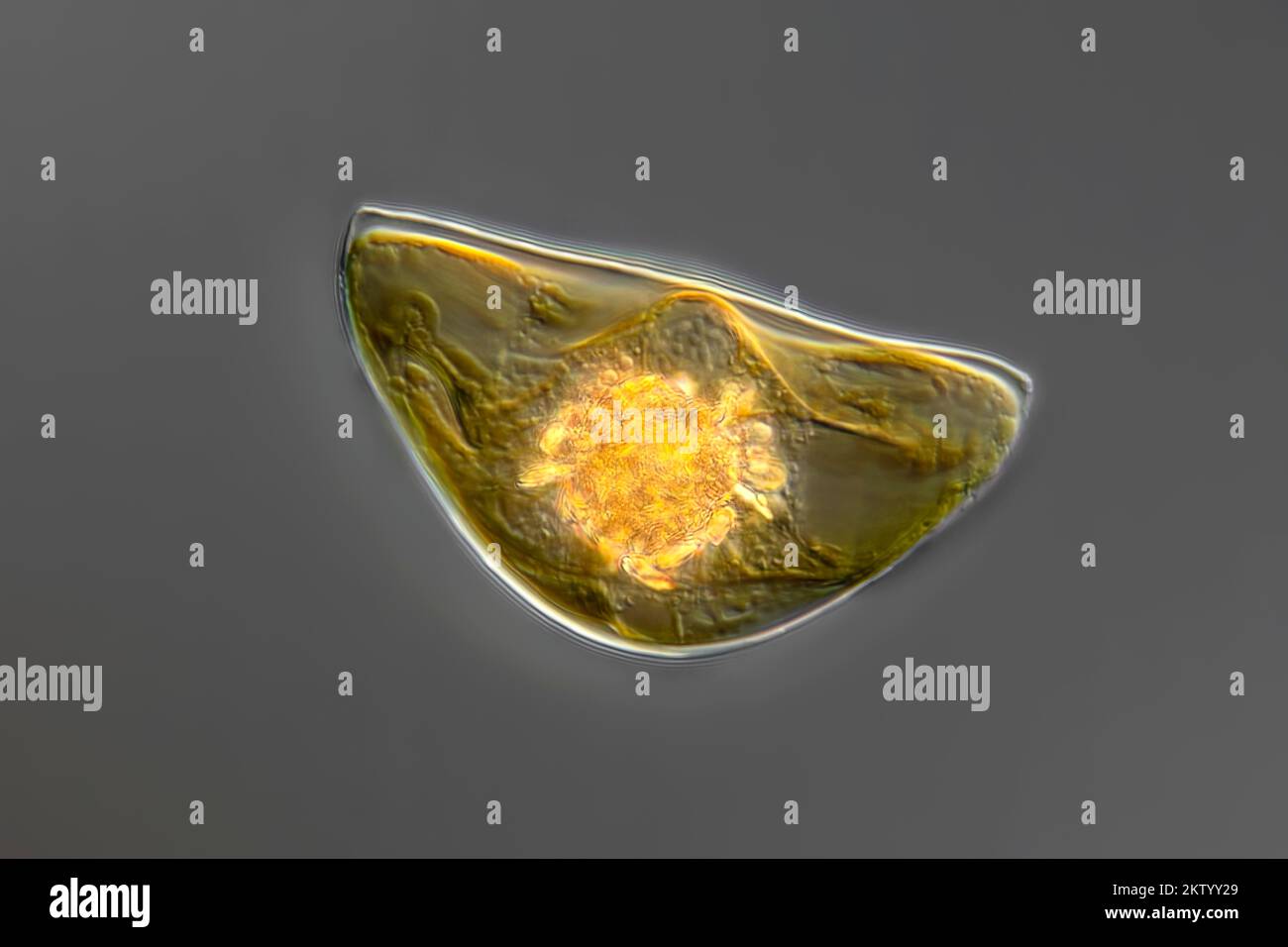 Pyrocystis sp. cf. algae, light micrograph Stock Photo - Alamy