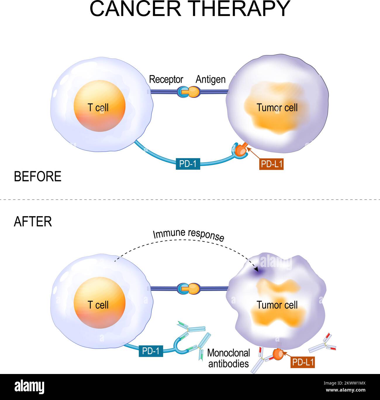 Cancer therapy of monoclonal antibodies. treatment of endometrial
