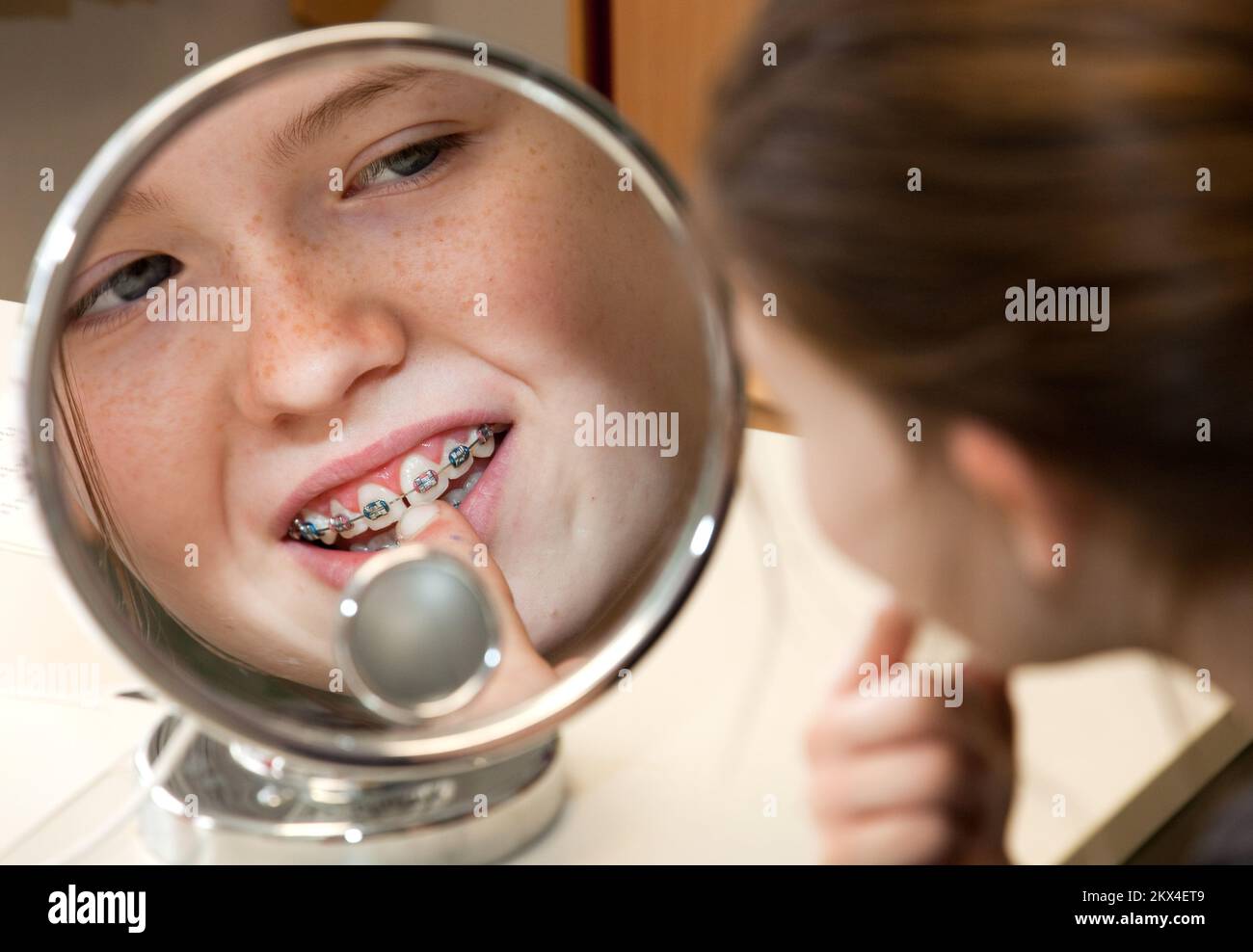 Netherlands, a girl is looking at her dental braces. Dental braces