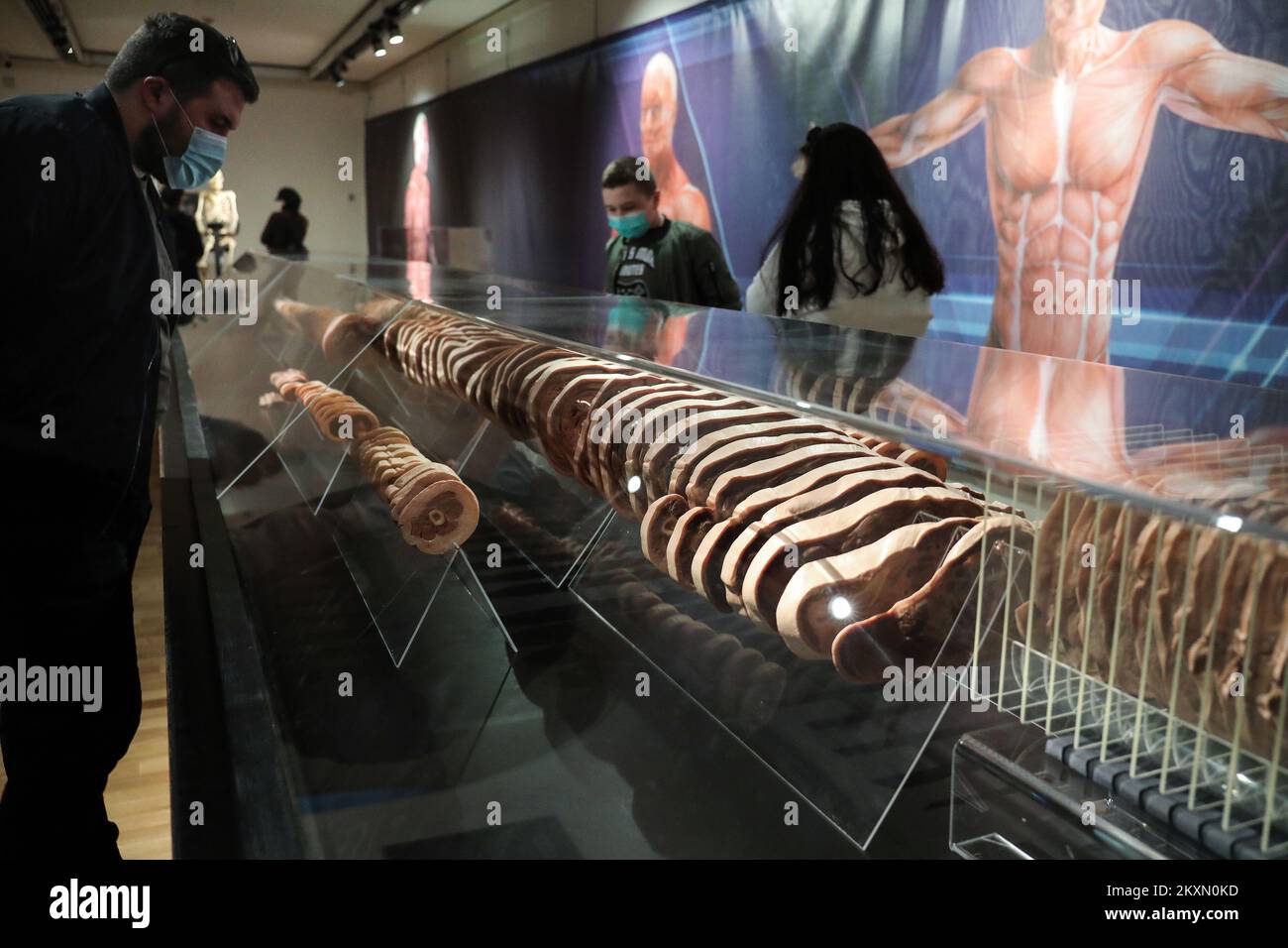 Visitor looks human body hi-res stock photography and images - Alamy