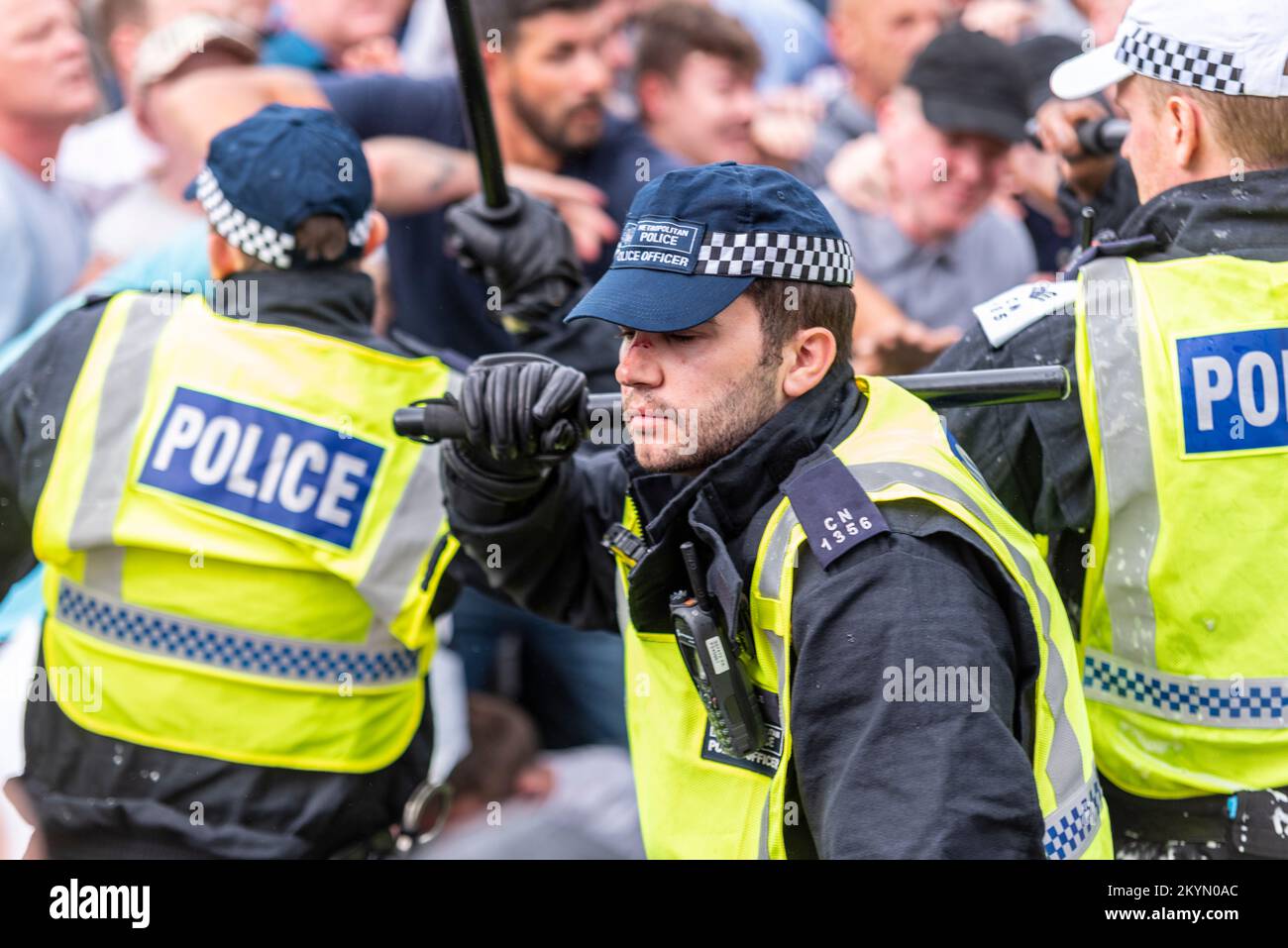 Supporters of Tommy Robinson such as the EDL protested in London demonstrating for his release after arrest. Injured police officer with bloodied nose Stock Photo