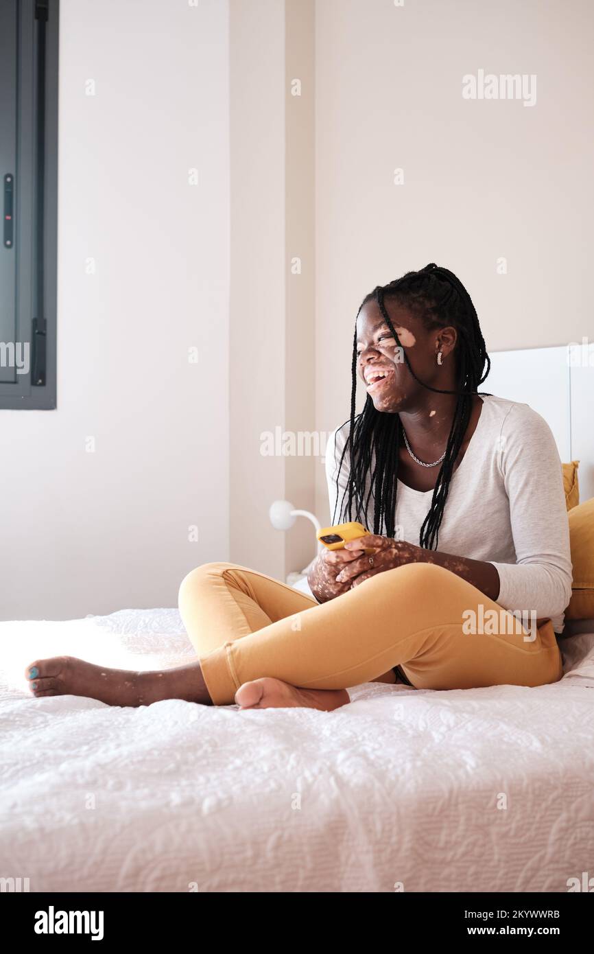 https://c8.alamy.com/comp/2KYWWRB/cheerful-black-woman-with-vitiligo-sitting-on-bed-using-mobile-phone-2KYWWRB.jpg