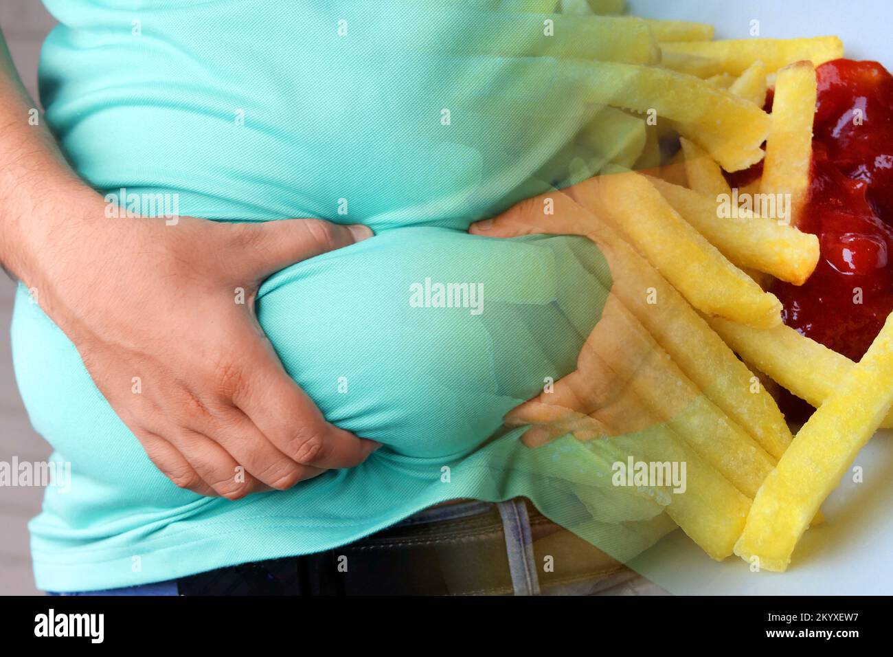 Obesity and junk food. Man clutching his belly fat and French fries with ketchup. Stock Photo