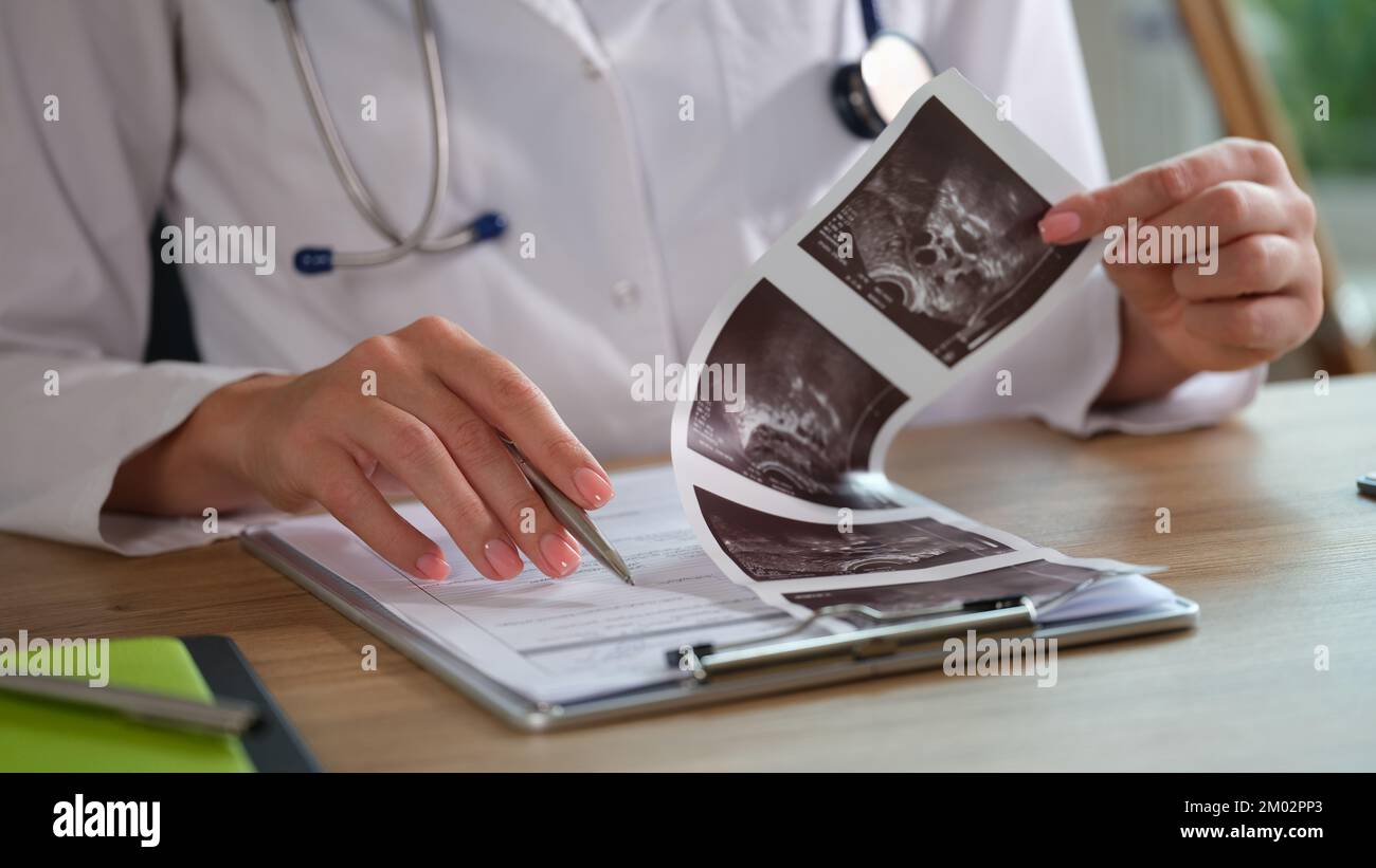 Female doctor analyzes ultrasound results for patient diagnosis Stock ...